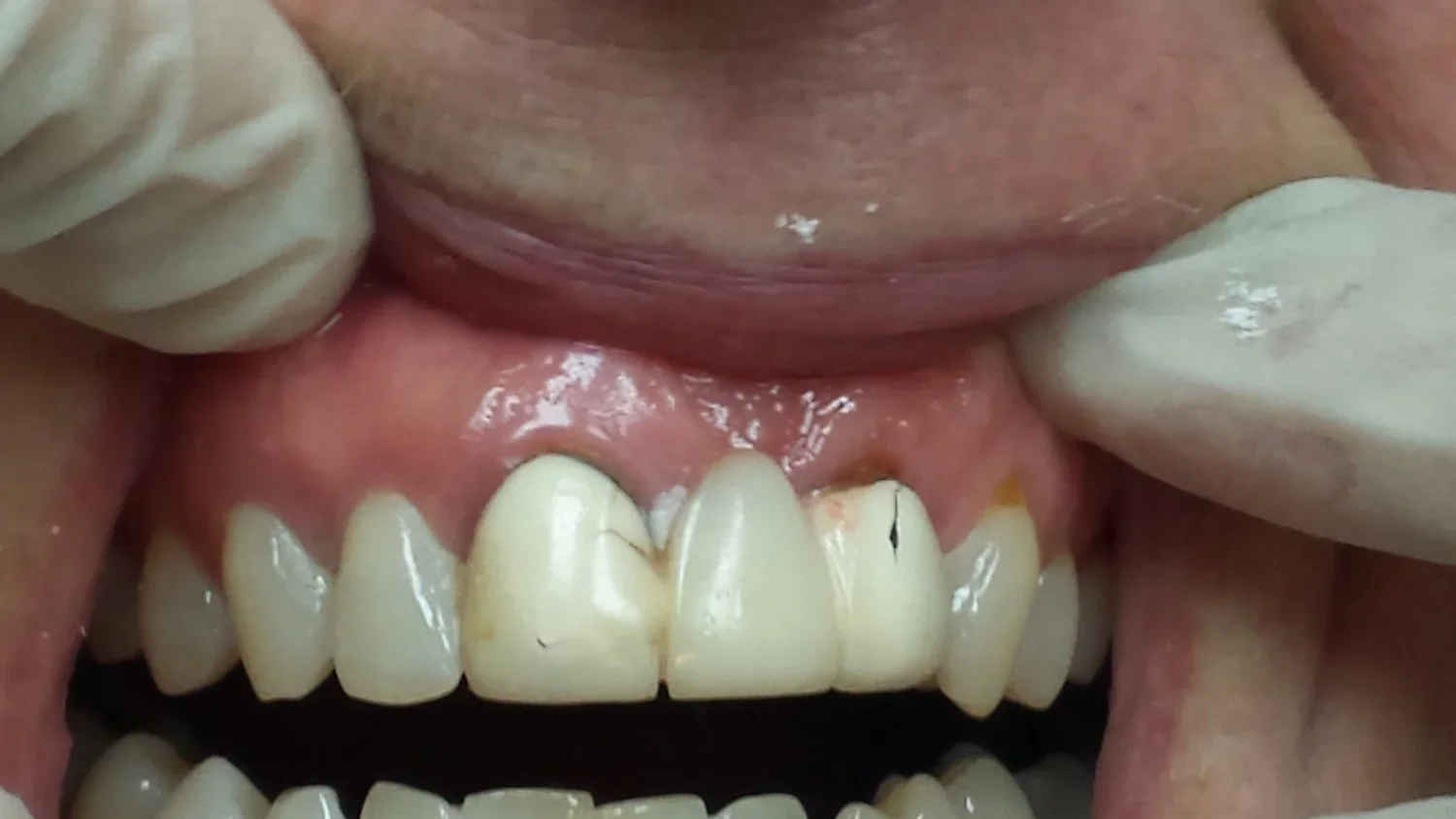 BEFORE - Brianne (Copy) (Copy)