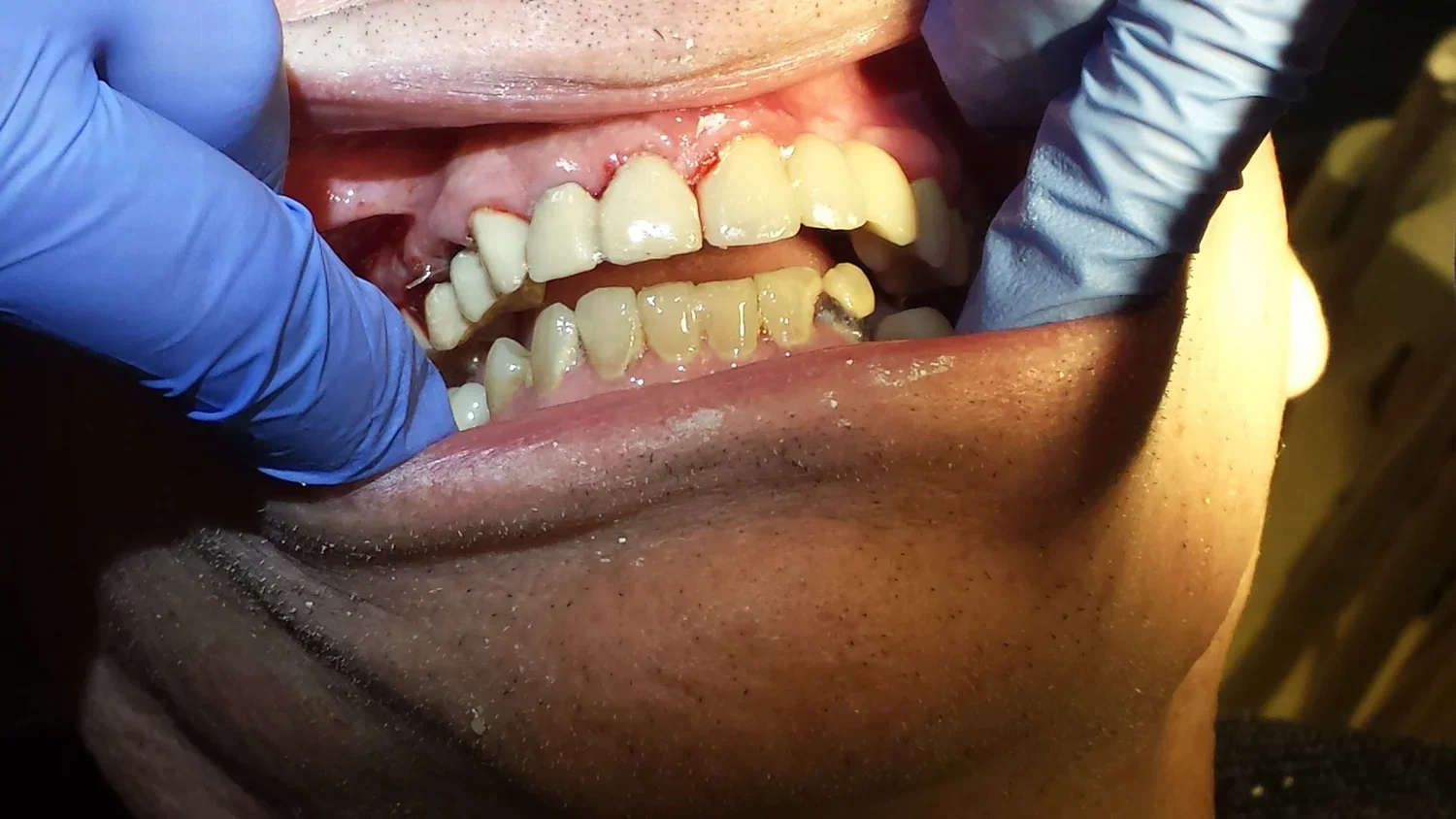 AFTER - Bill (Copy) (Copy)