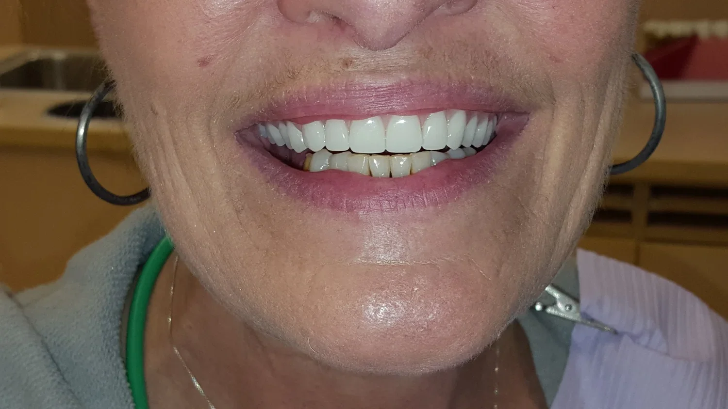 AFTER - Dierdre (Copy) (Copy)