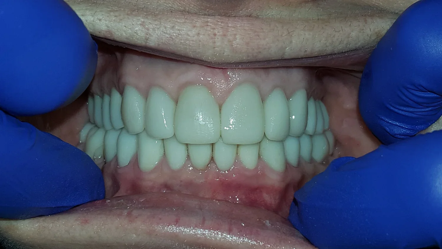 AFTER- Jim (Copy) (Copy)