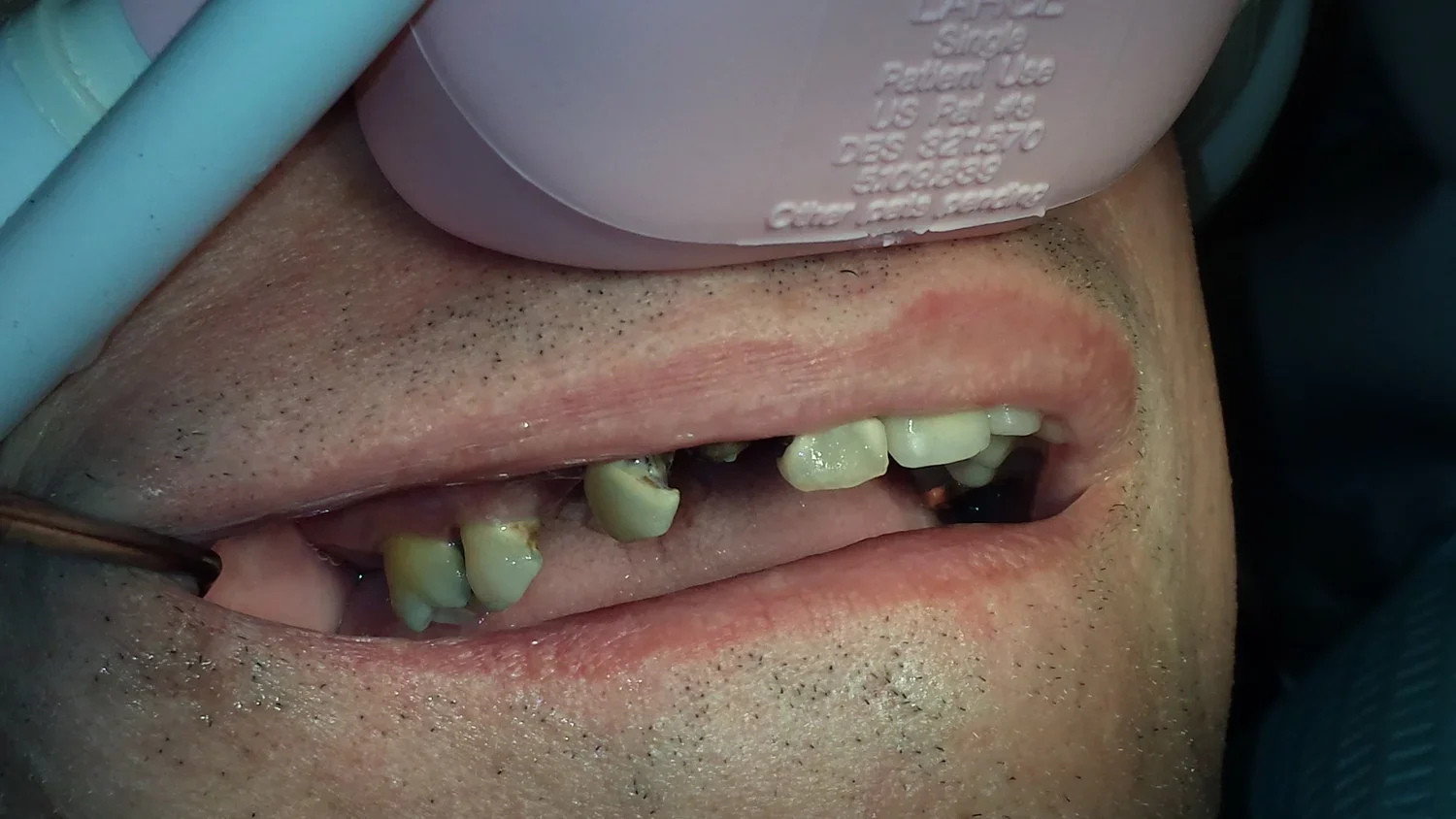 BEFORE - Bill (Copy) (Copy)