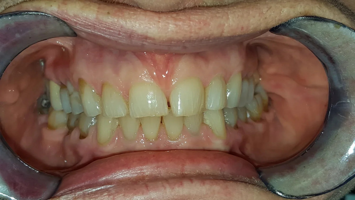 BEFORE - Jim (Copy) (Copy)