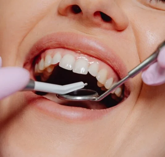 Close-up of a person's open mouth during a dental examination, with dental tools in use.