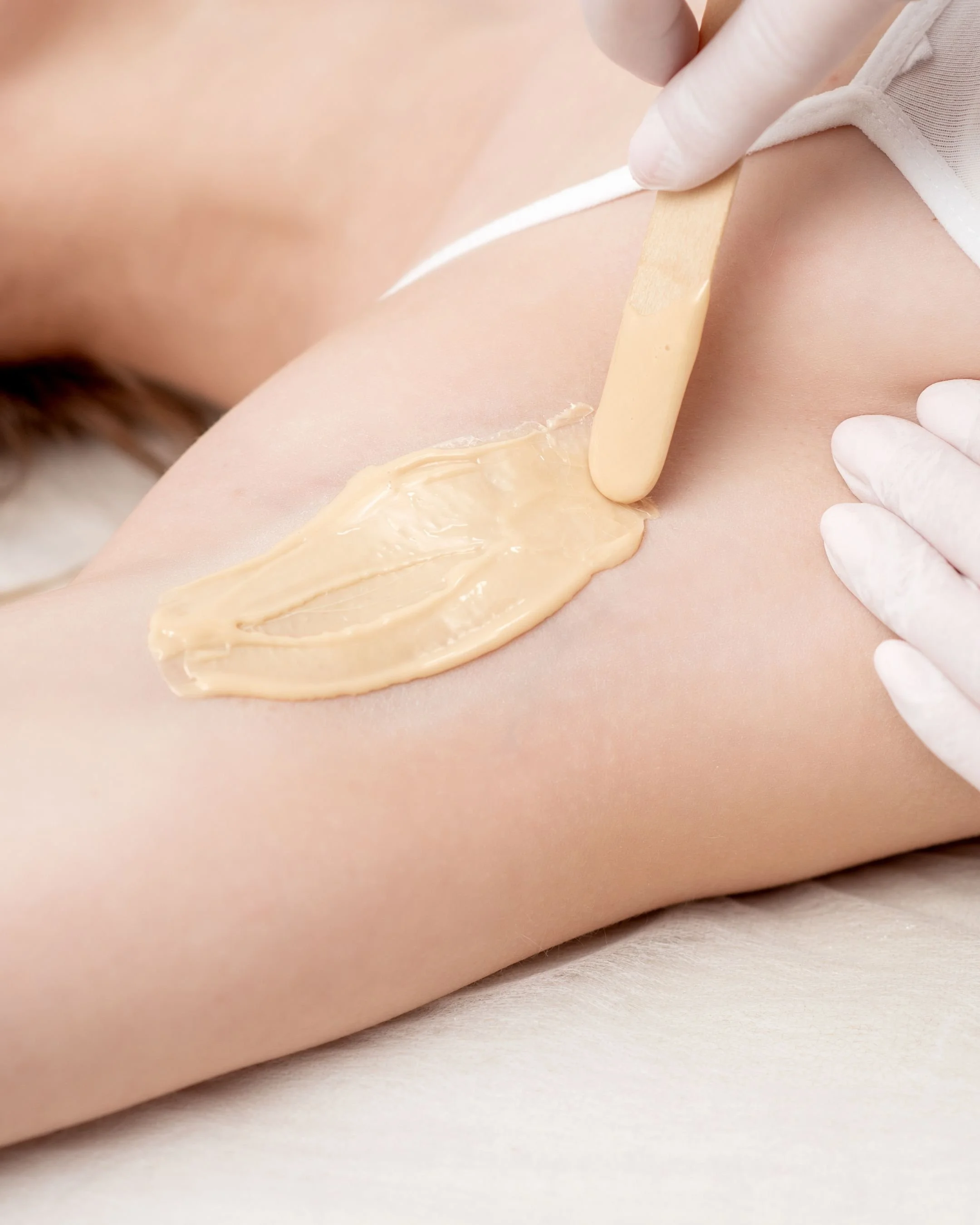 A person getting a waxing treatment on their underarm with hot wax applied and being removed.