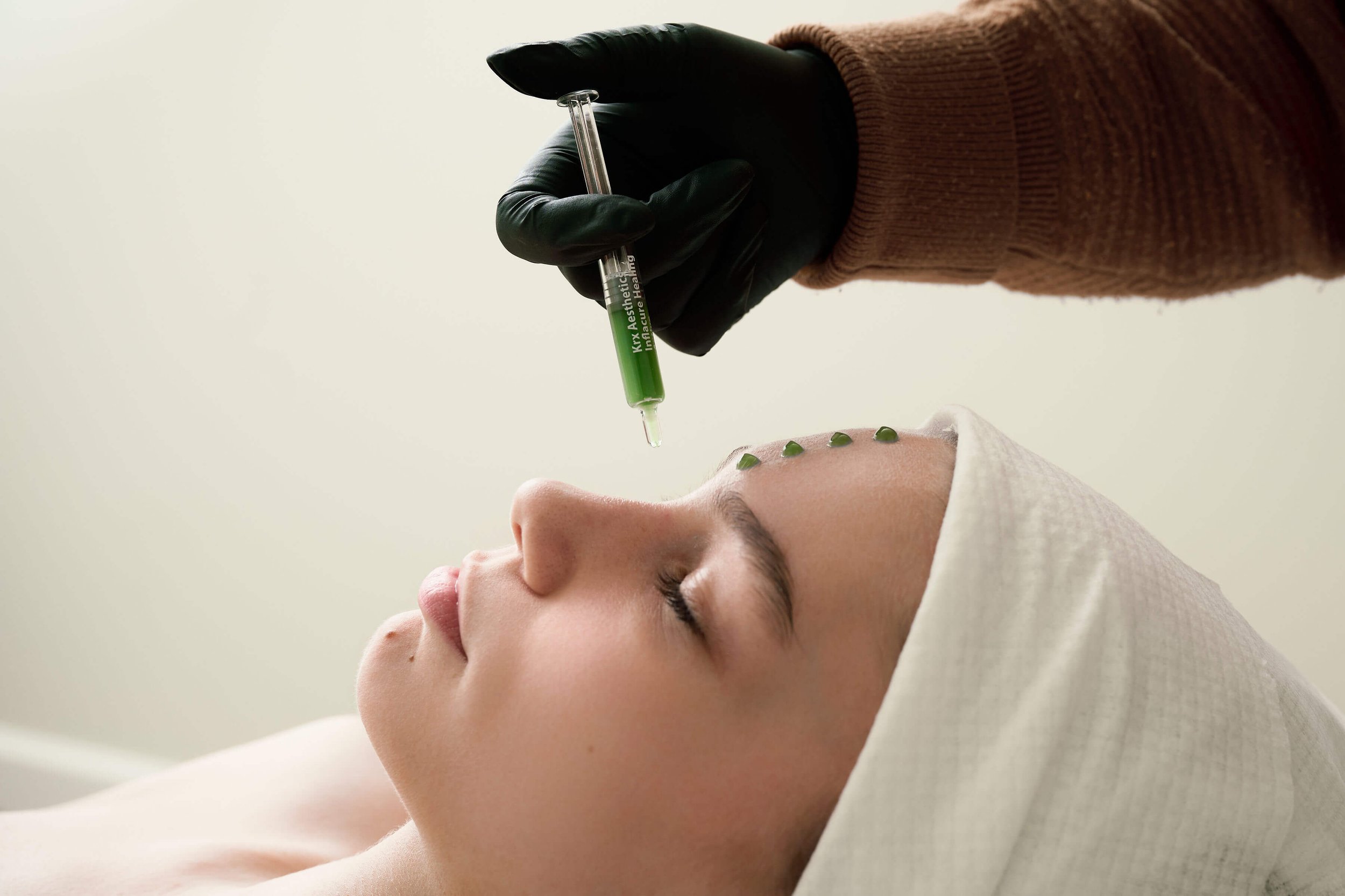 A woman receiving a cosmetic facial treatment with micro-needling or injections, with small green gel dots on her forehead, while a practitioner in black gloves applies a green serum using a syringe.