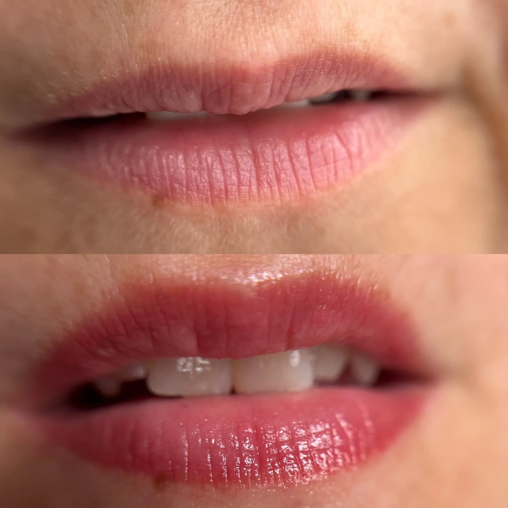 Nahaufnahme von geöffneten Lippen mit sichtbaren Zähnen und Zunge im Mund.
