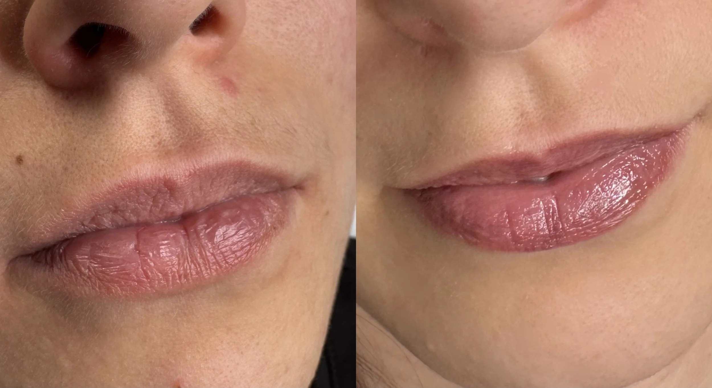 Lippen Pigmentierung