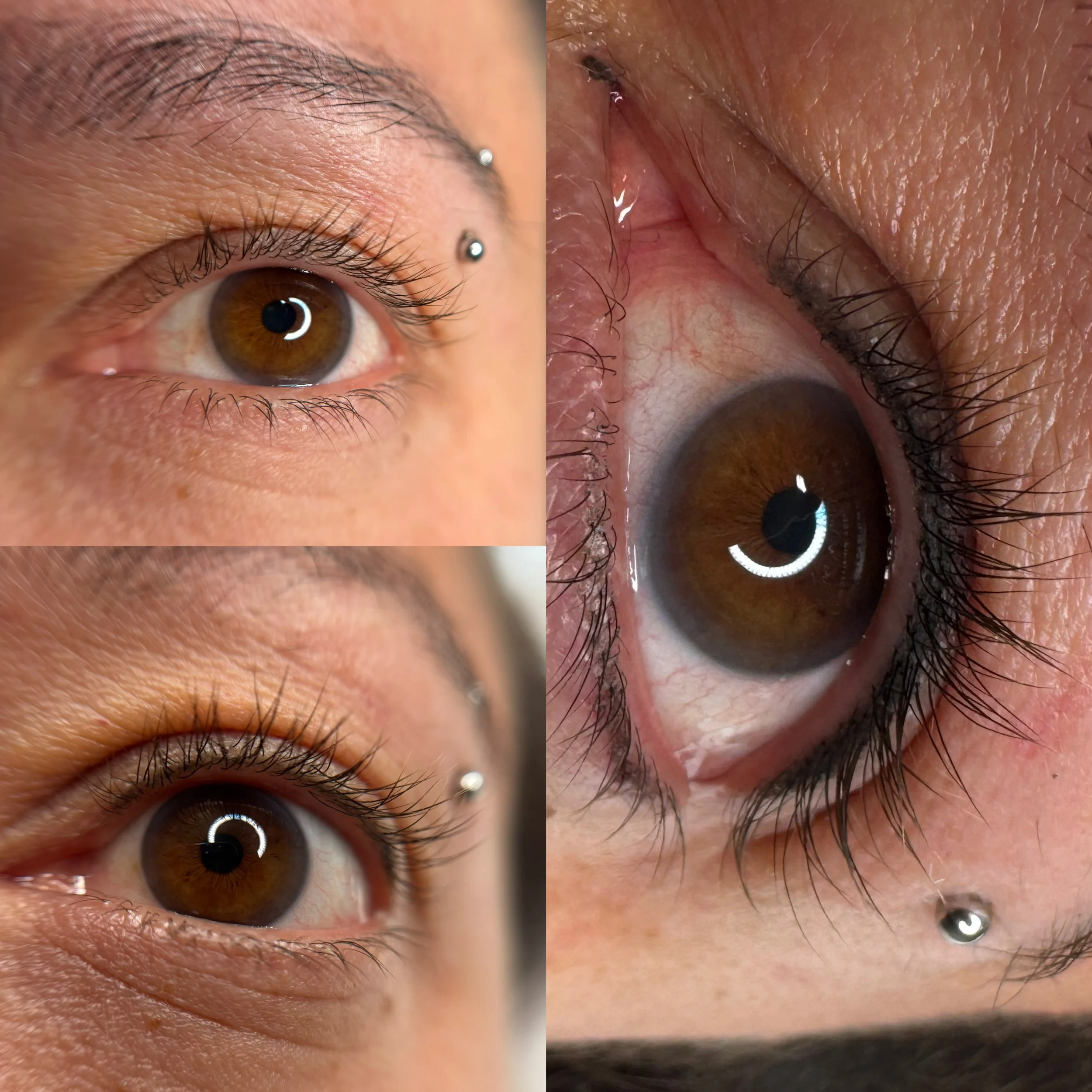 Nahaufnahme eines menschlichen Auges, das sich im Zustand der Untersuchung befindet, mit Fokus auf die Iris und die Pupille. Die Augenlidhaut und die Wimpern sind sichtbar.