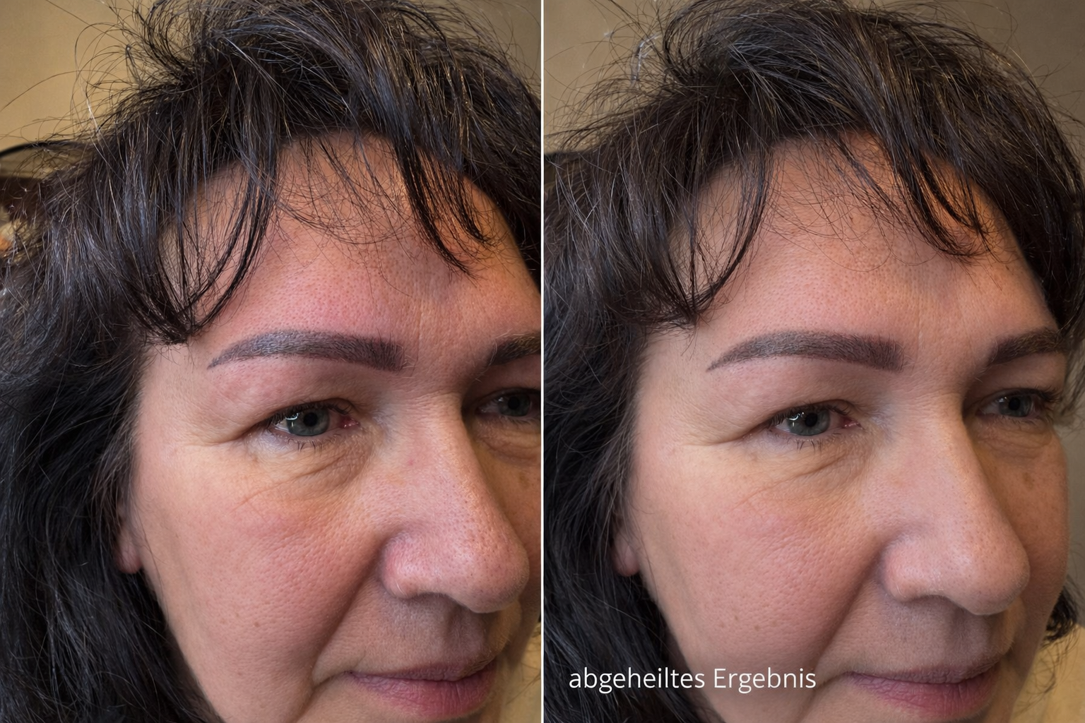 Verheilte Powderbrows VOI SCHEE WEICHS