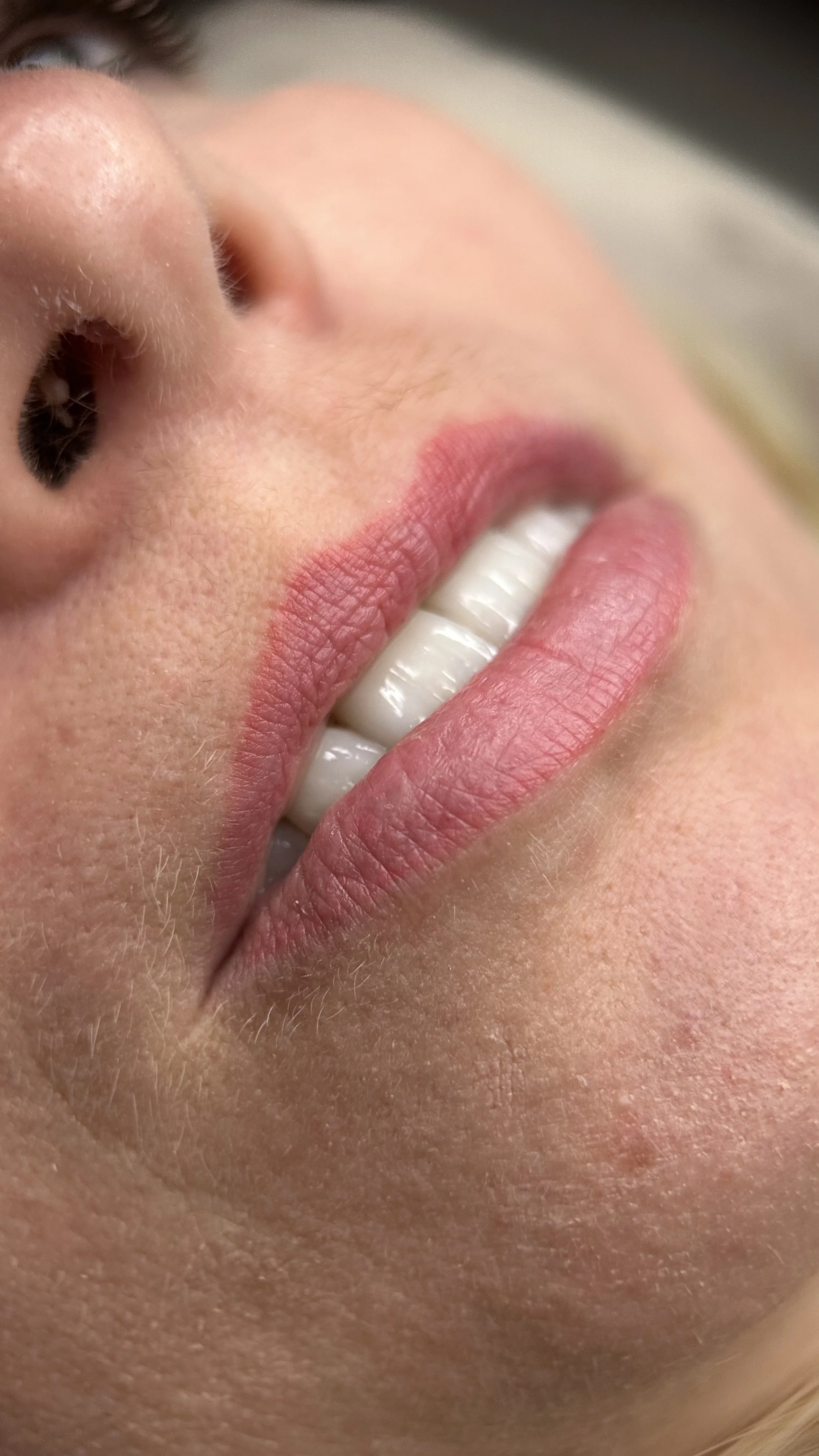Nahaufnahme eines lachenden Gesichts mit sichtbaren Zähnen, Lippen und Nase.