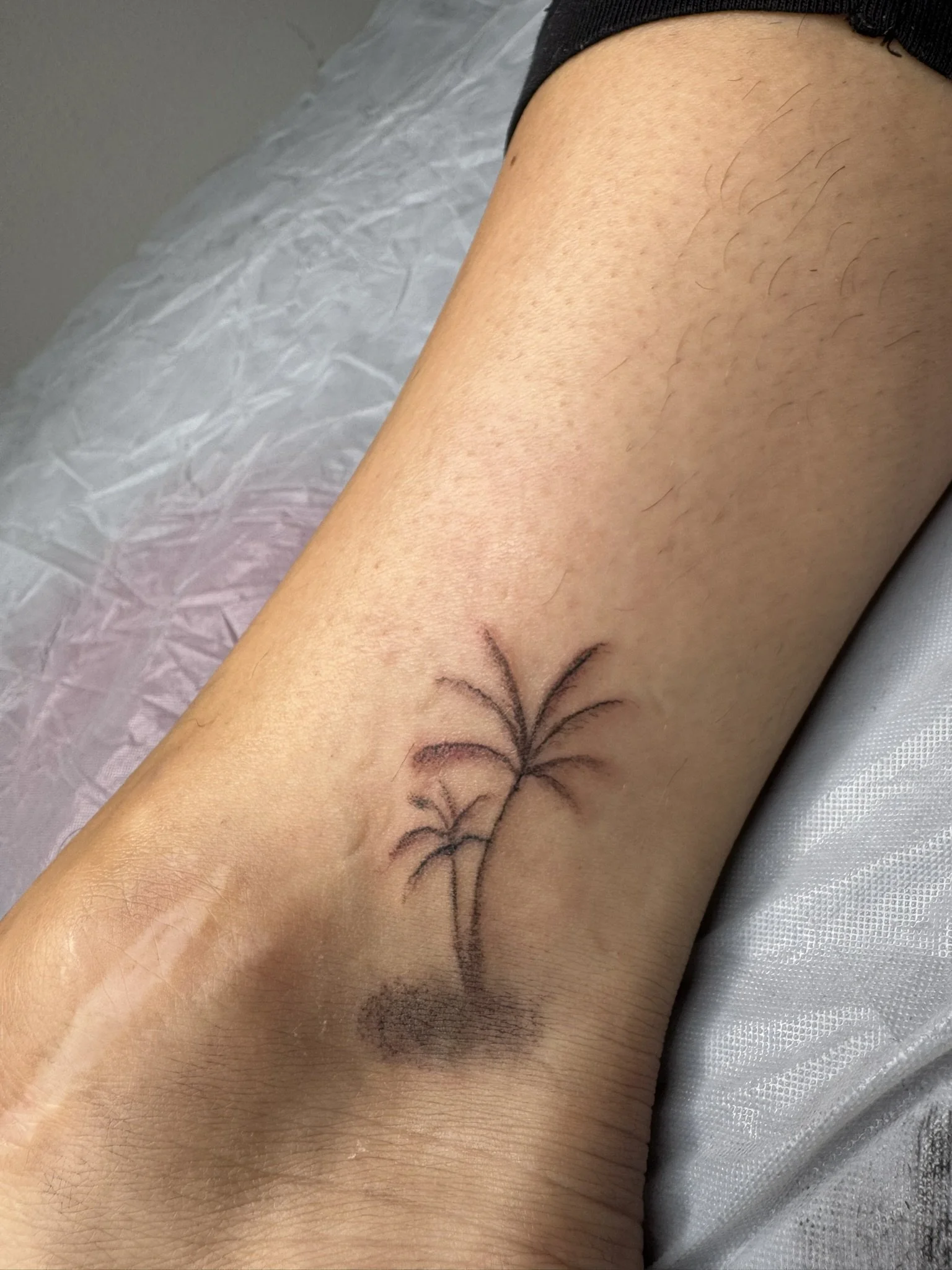 Frisch gestochenes kleines Fine Line Palmen-Tattoo mit leichter Schattierung