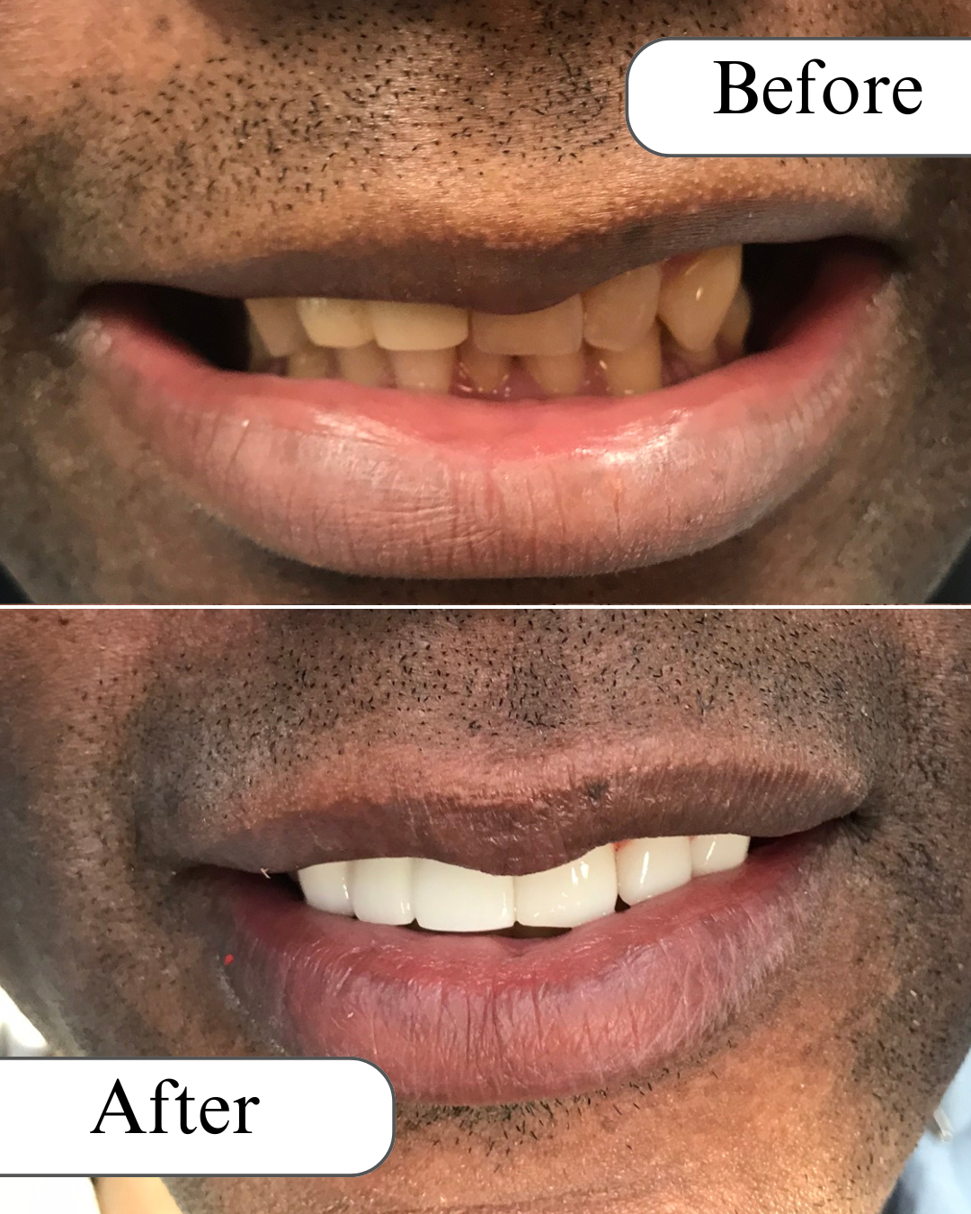 Radiance Dental IG (1).png