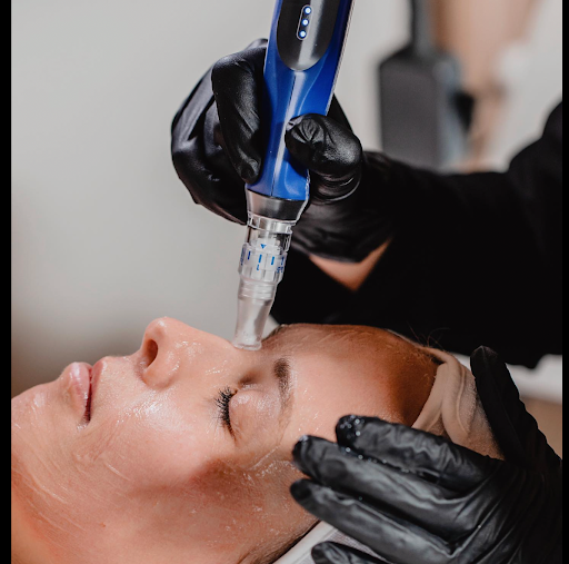 Restore, Repair &amp; Glow: Microneedling &amp; Dermalux LED Therapy Tauranga