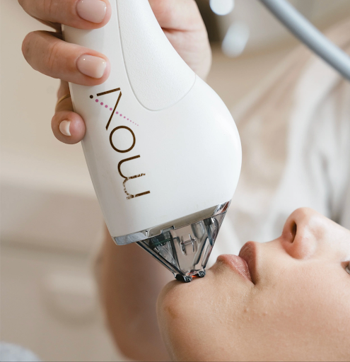 FAQs: What Does MOXI Laser Do? And More…