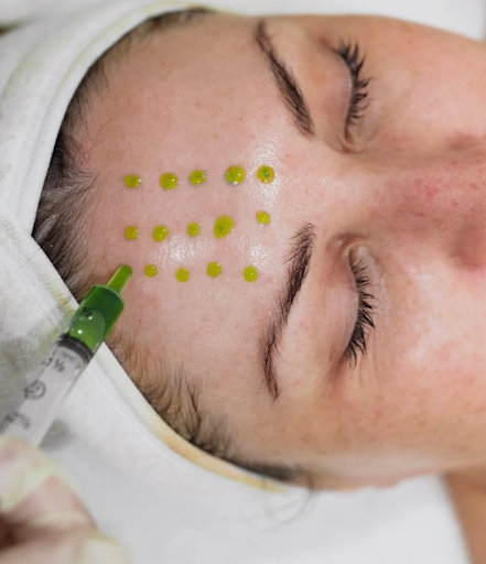 Dullness Out, Glow In: Discover Dermal Glow’s Clinical Peel Magic