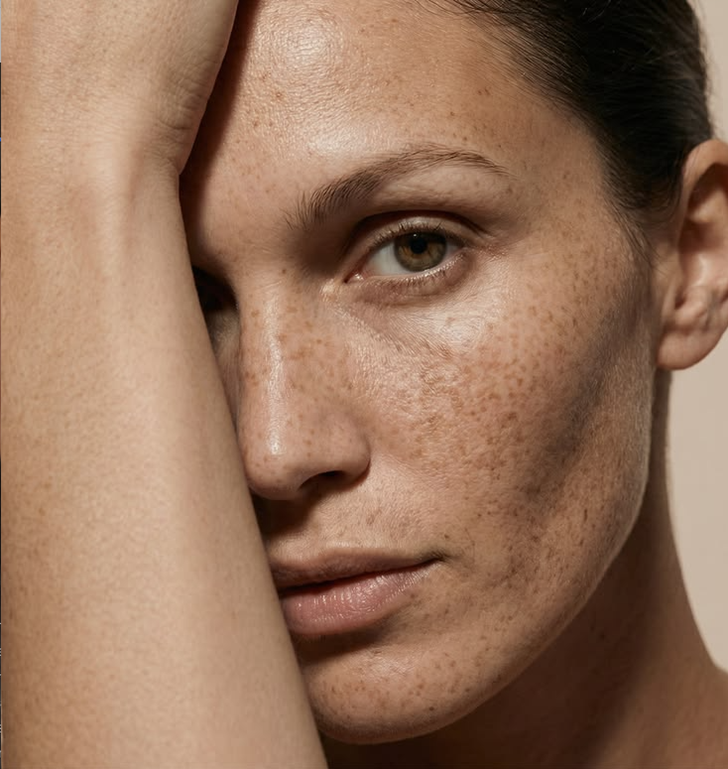 Pigmentation