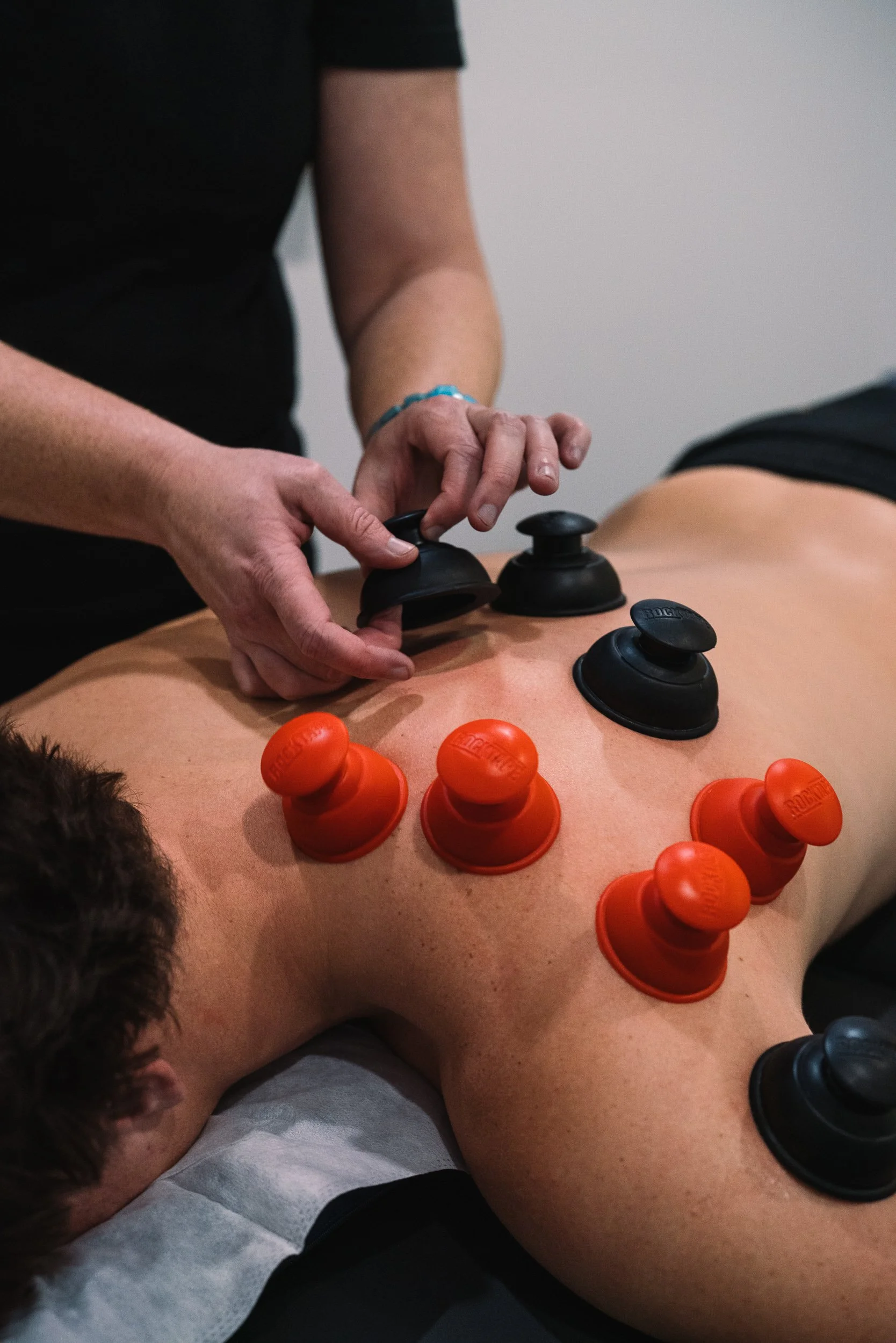 SurfEdge Sports Physiotherapy Maroochydore offers a variety of services including massage, cupping, exercise based rehabilitation, sports physiotherapy, dry needling
