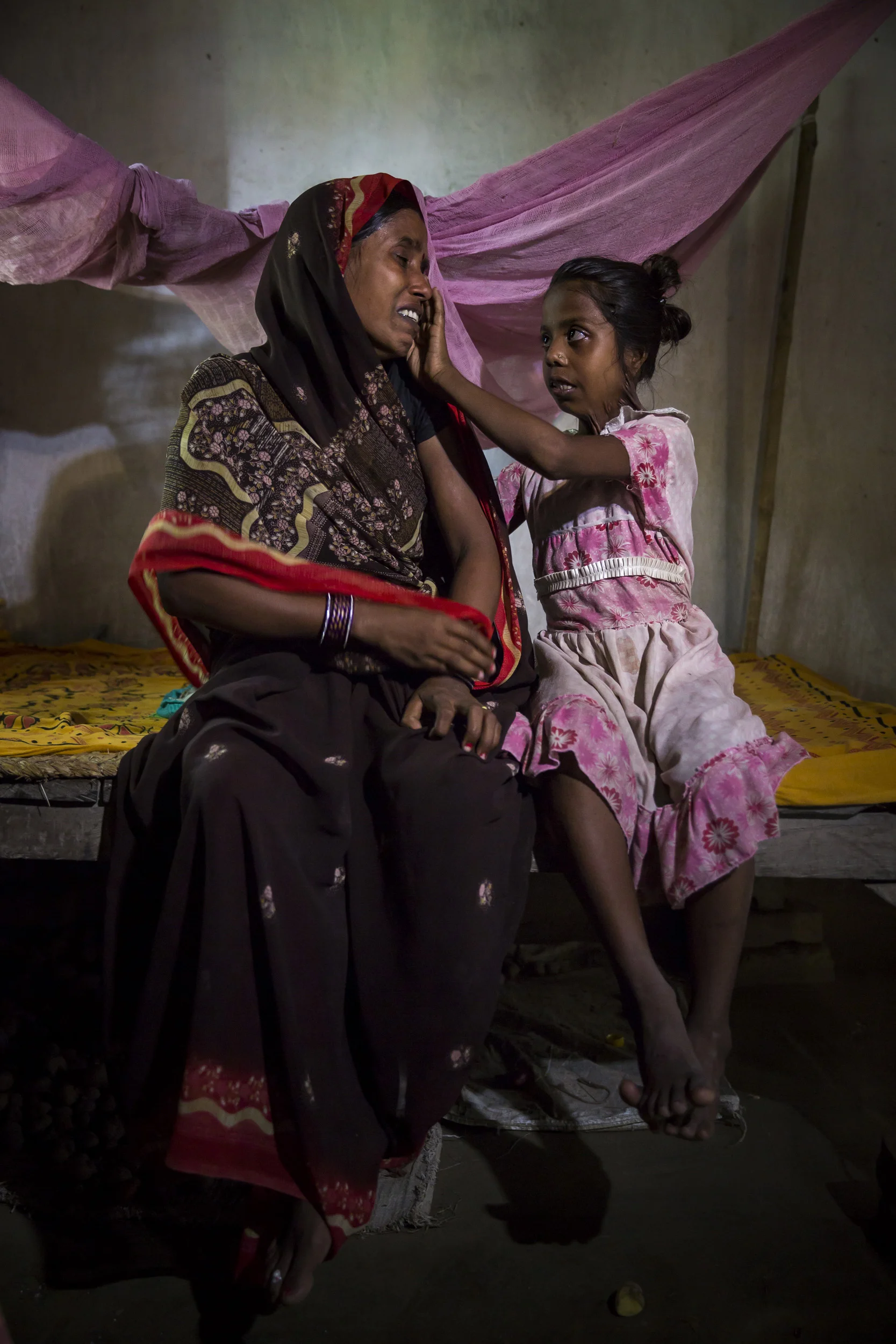 MUZZAFARPUR, INDIA, 5 SEPTEMBER 2014: Ragini Kumari, 10, was badly burnt by a Kerosene fire when she was 2 years old, she is one of over 6 million people burnt in India every year. Ragini has suffered constrictions of her neck and shoulders and live