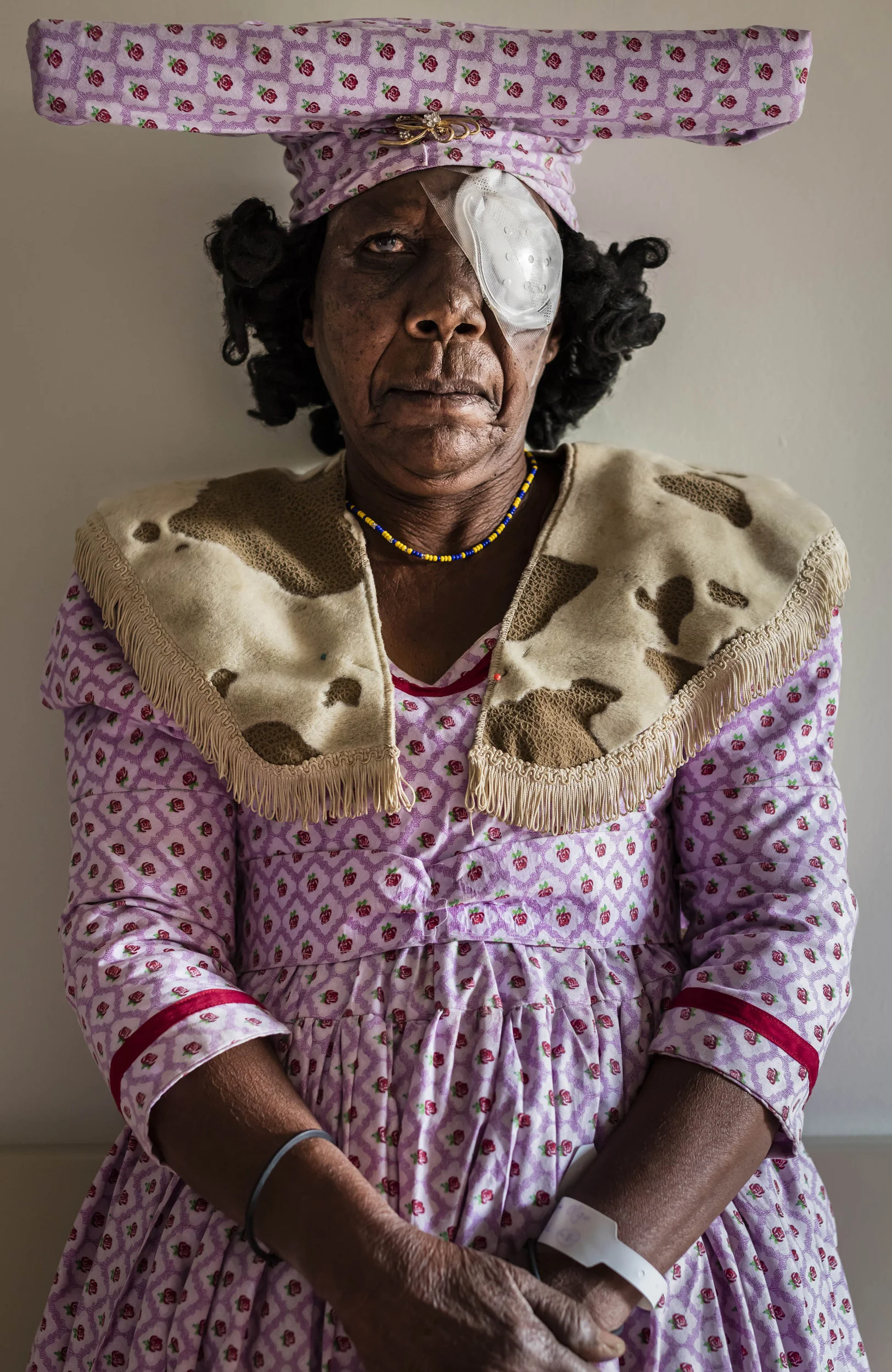 OMARURU, NAMIBIA, 4 November 2015: An Herero woman waits for her bandages to be removed after undergoing cataract surgery the previous day at Omaruru District Hospital. Most of the people who undergo this kind of eye surgery will recover a degree of