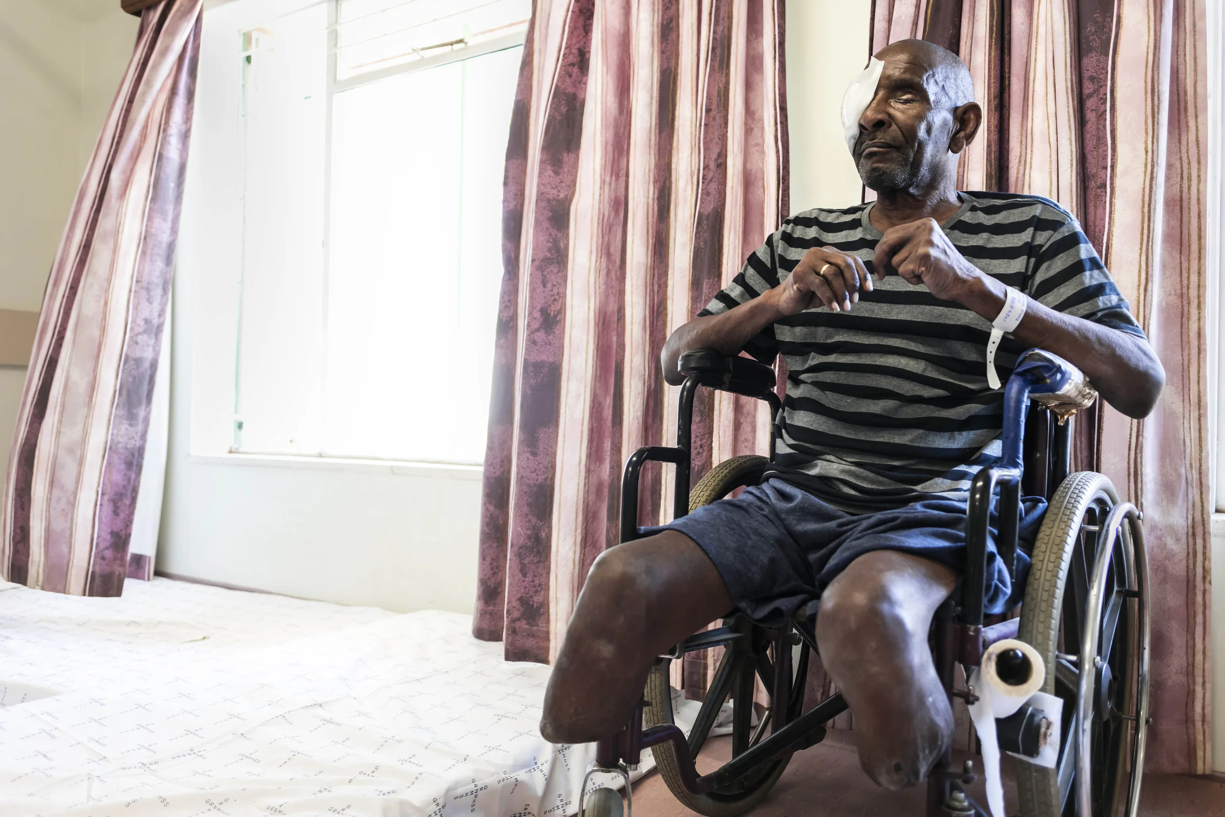 OMARURU, NAMIBIA, 2 November 2015:This man suffers from severe diabetes and has lost one eye and his legs to the disease. Diabetes is the most common cause of blindness in the developed world and the damage it inflicts on sight is often not detected