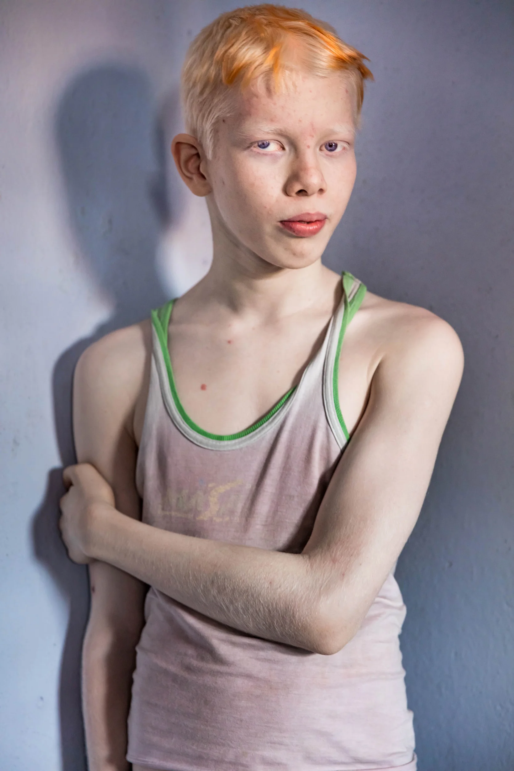 VIVEKANANDA MISSION ASRAM, HALDIA, WEST BENGAL, INDIA, JANUARY 14, 2016: A young boy with severely impaired vision seen in the hostel residence of the Vivekananda Mission Asram school for the blind. This is the highest rated school for blind childre