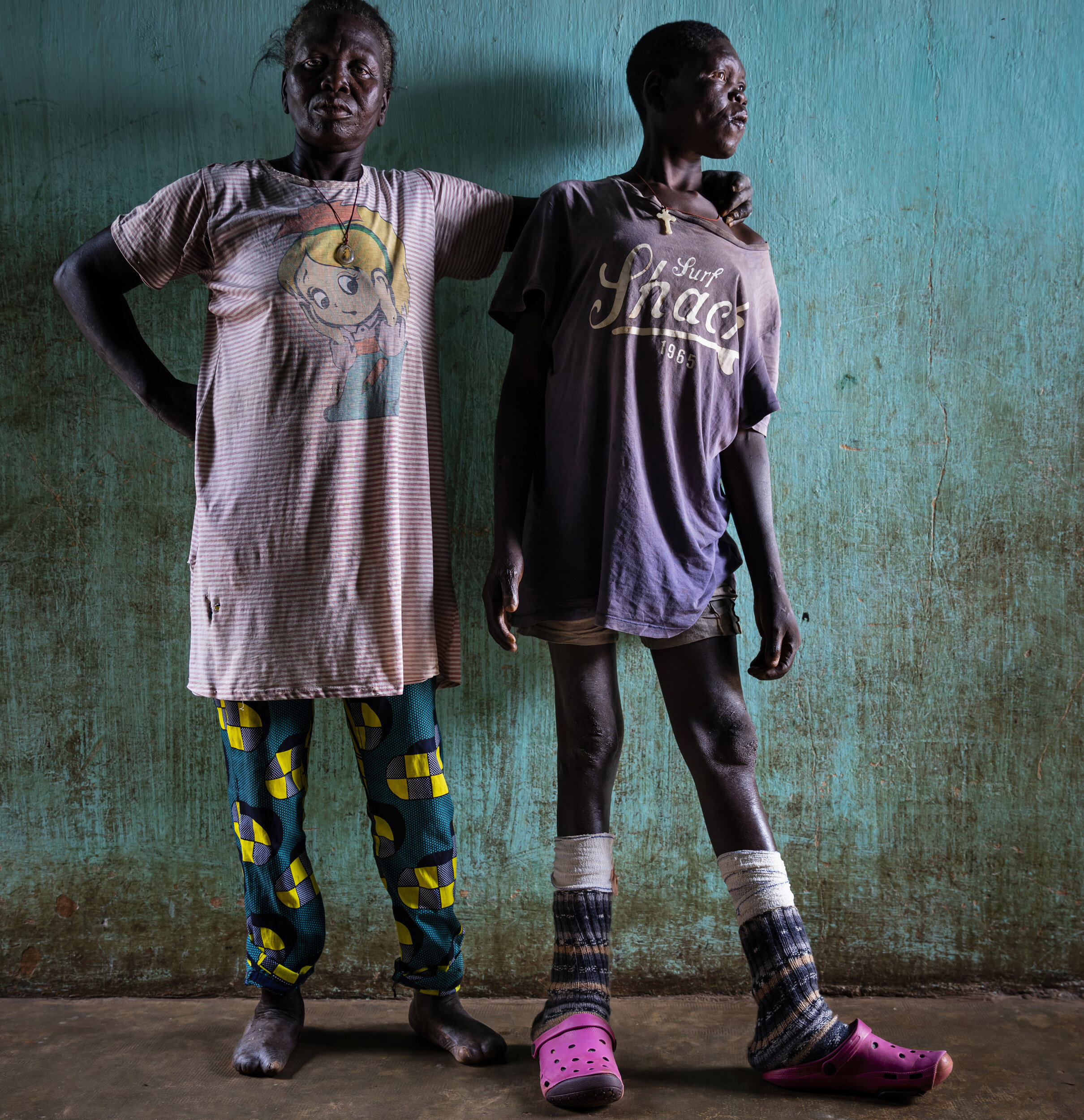 MADJRE, DOGBO, BENIN, OCTOBER 22, 2019: Mother and Son, Angele Assi, 54 and her son Cyprien Tohou Egnon, 25. They have lived at the Madjre Anti-Leprosy center since 2017. In addition to Leprosy, Cyprien has some mental issues linked to the disease.