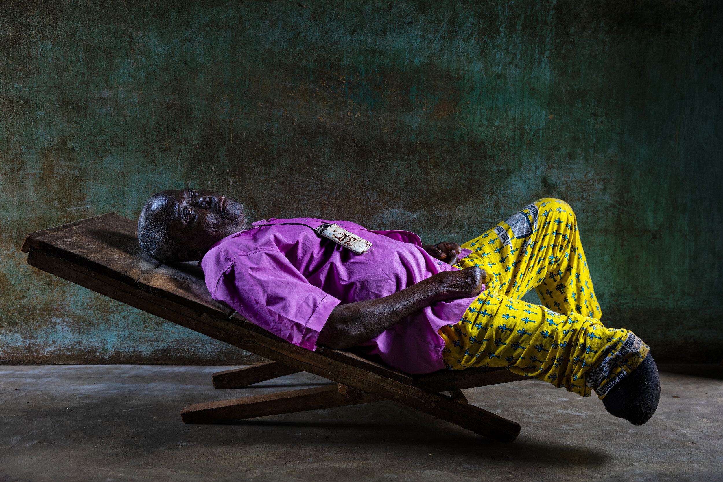 MADJRE, DOGBO, BENIN, OCTOBER 22, 2019: Gilbert Abalo, 55, is a child victim of Leprosy, he has suffered from the symptoms for over 40 years. He has lived at the Madjre Anti-Leprosy center for over 25 years. He lost his leg to gangrene over 6 years