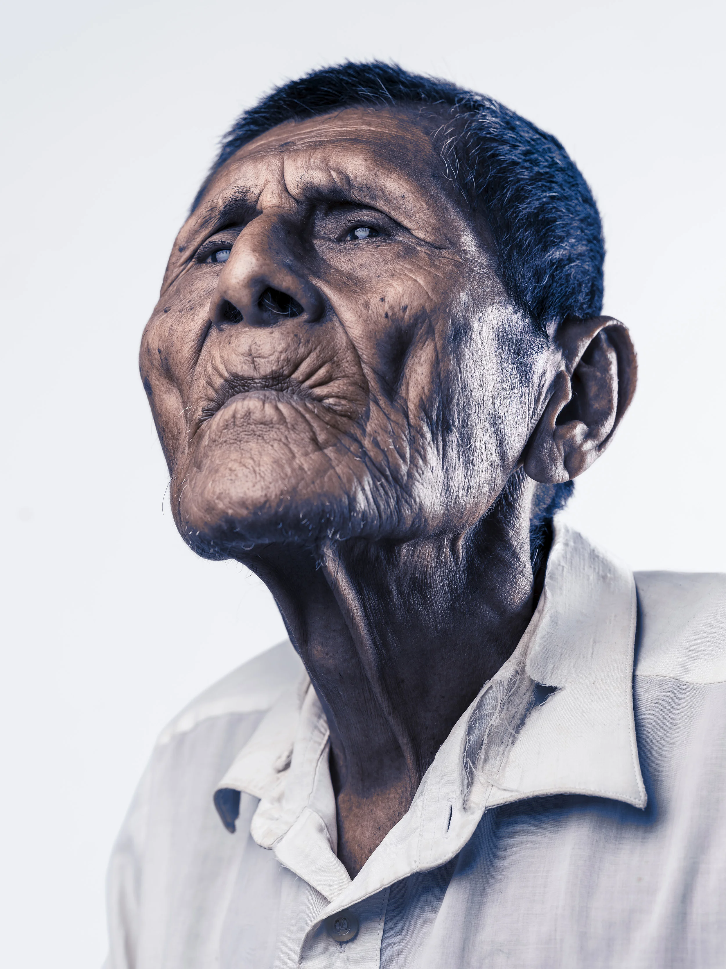 TARAPOTO, PERU, AUGUST 2017: Portraits of patients at a SEE International Eye camp in the Peruvian town of Tarapoto. SEE offers free eye surgery to poor communitie around the world who cannot afford or access eye care any other way. SEE relies on do