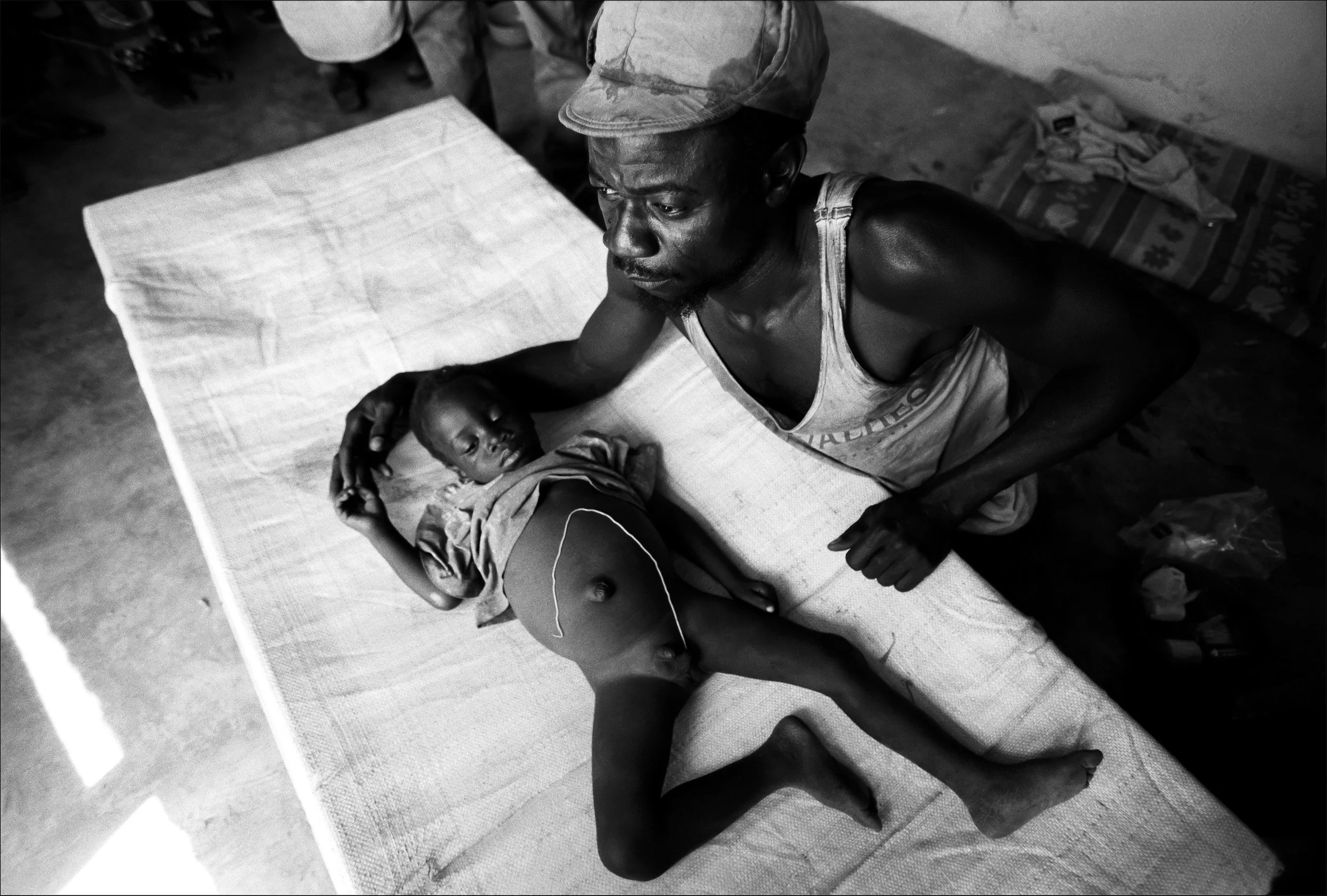 NORTH GHANA: A worried father watches over his son as a guinea worm is removed in stages from the boys testicles. Guinea worm is a parasite which lives in water holes in certain African countries. There is no other water source for these people and