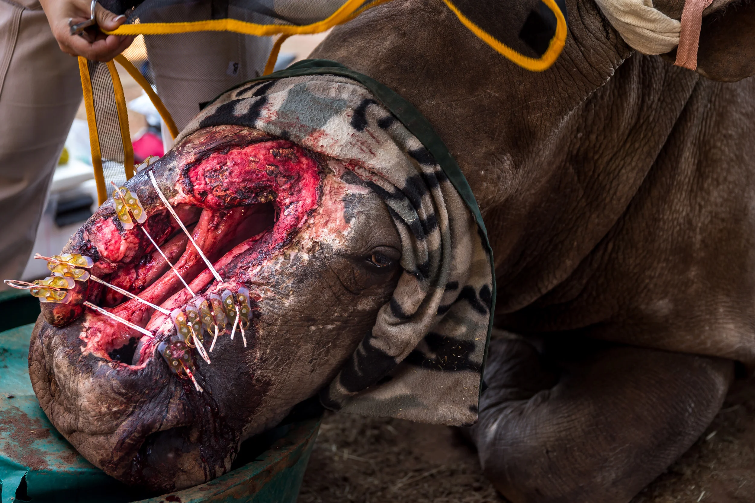 LIMPOPO, SOUTH AFRICA, 2 APRIL 2016: “Shoelaces on steroids.” That's how Saving the Survivors PR Spokesperson Suzanne Boswell Rudham described Tuesday's groundbreaking procedure using human abdominal surgery technology to stretch the wounded edges t