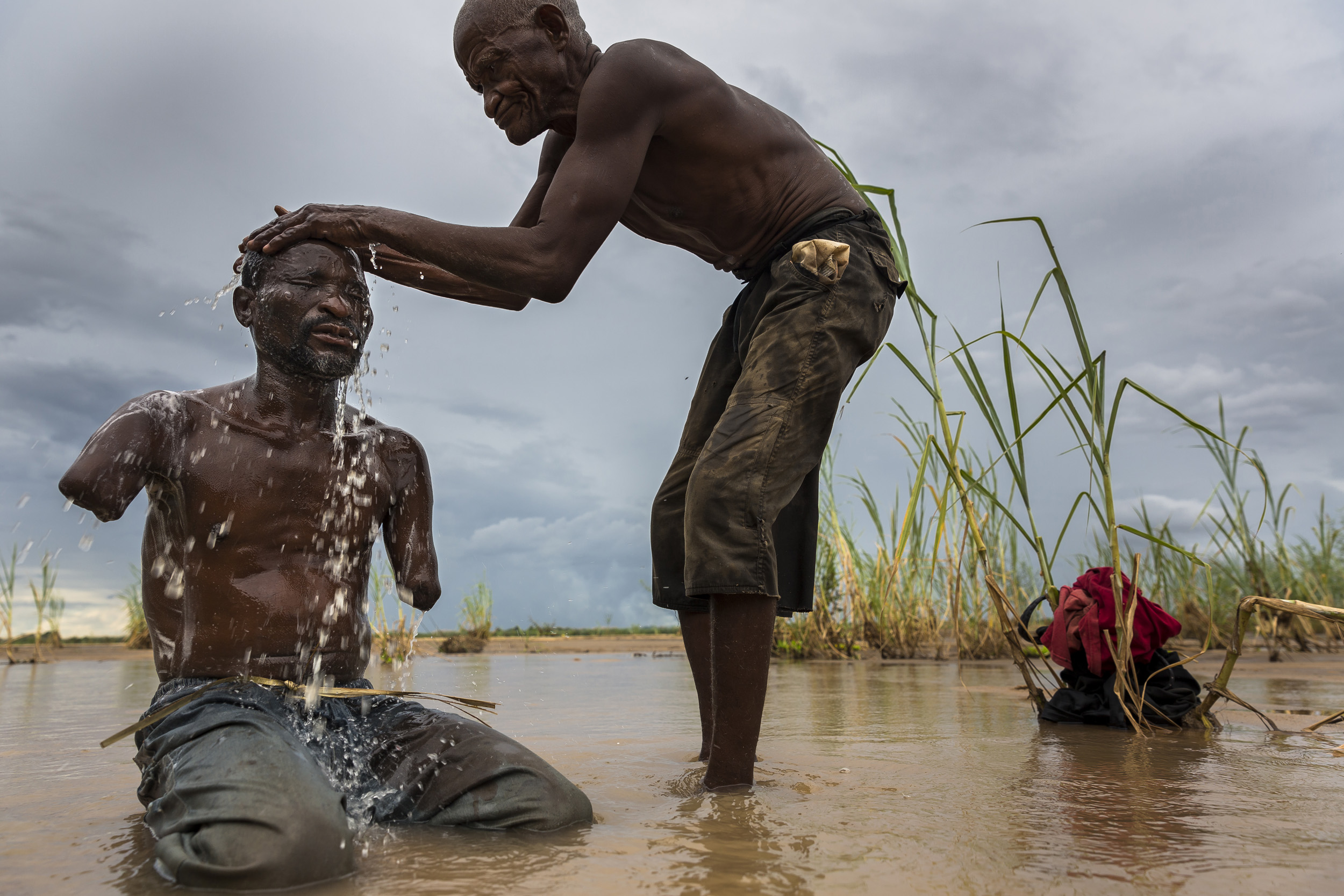 RIFIJI, SELOUS, TANZANIA, 4 MARCH 2013: Yusuf Shabani Difika, 41, lost both his arms to a lion attack on a fishing trip in the region of Selous National Park, Tanzania, 4 March 2013. The attack occured in the evening in 2005. The lion attacked Yusuf