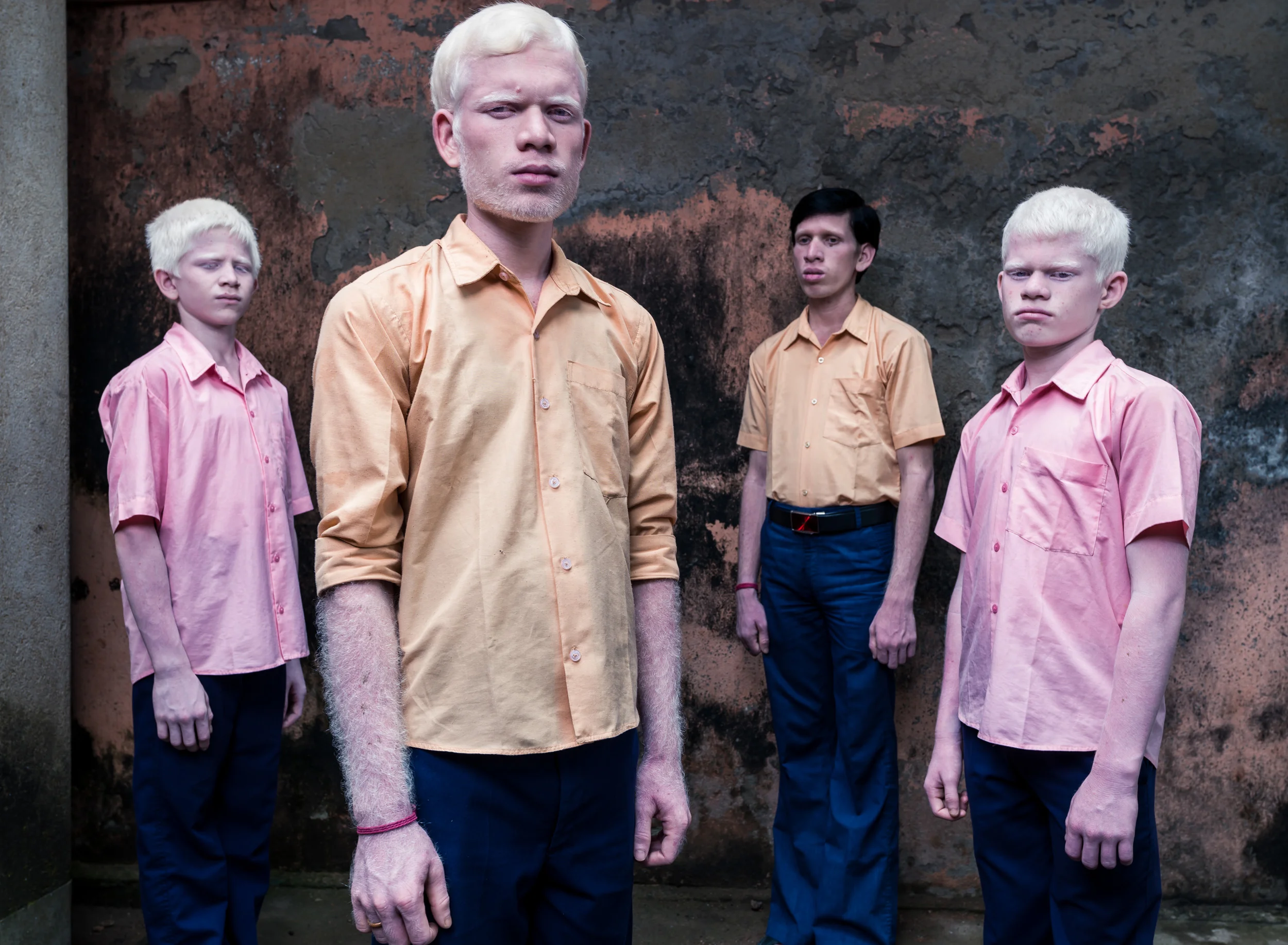 Blind Albino Boys - Vivekananda Mission School for the Blind - India, West Bengal, September 19, 2014.