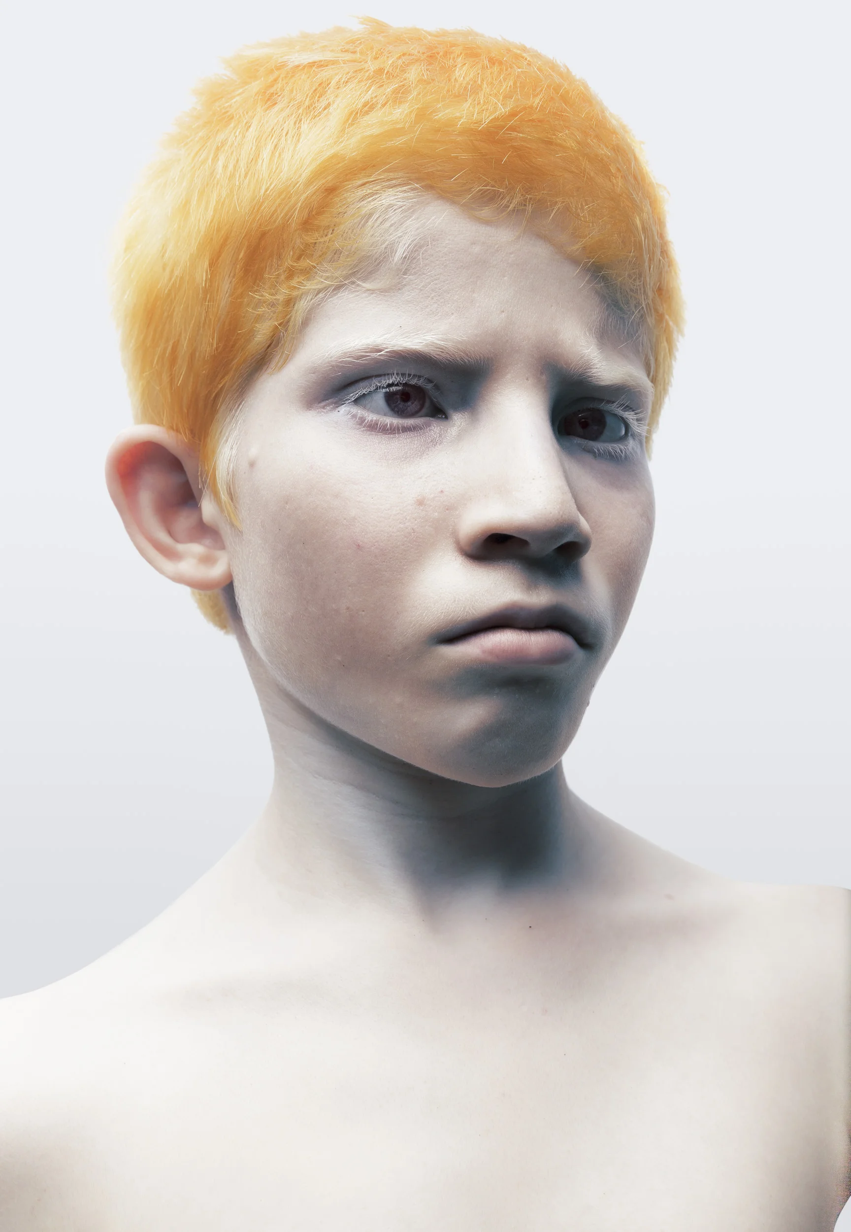 BlindAlbinism_13.jpg