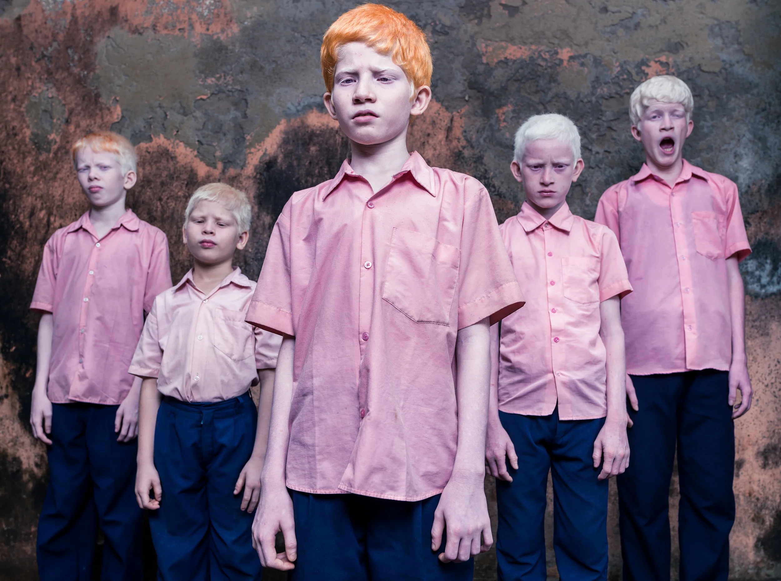 Blind Albino Boys - Vivekananda Mission School for the Blind - India, West Bengal, September 19, 2014.