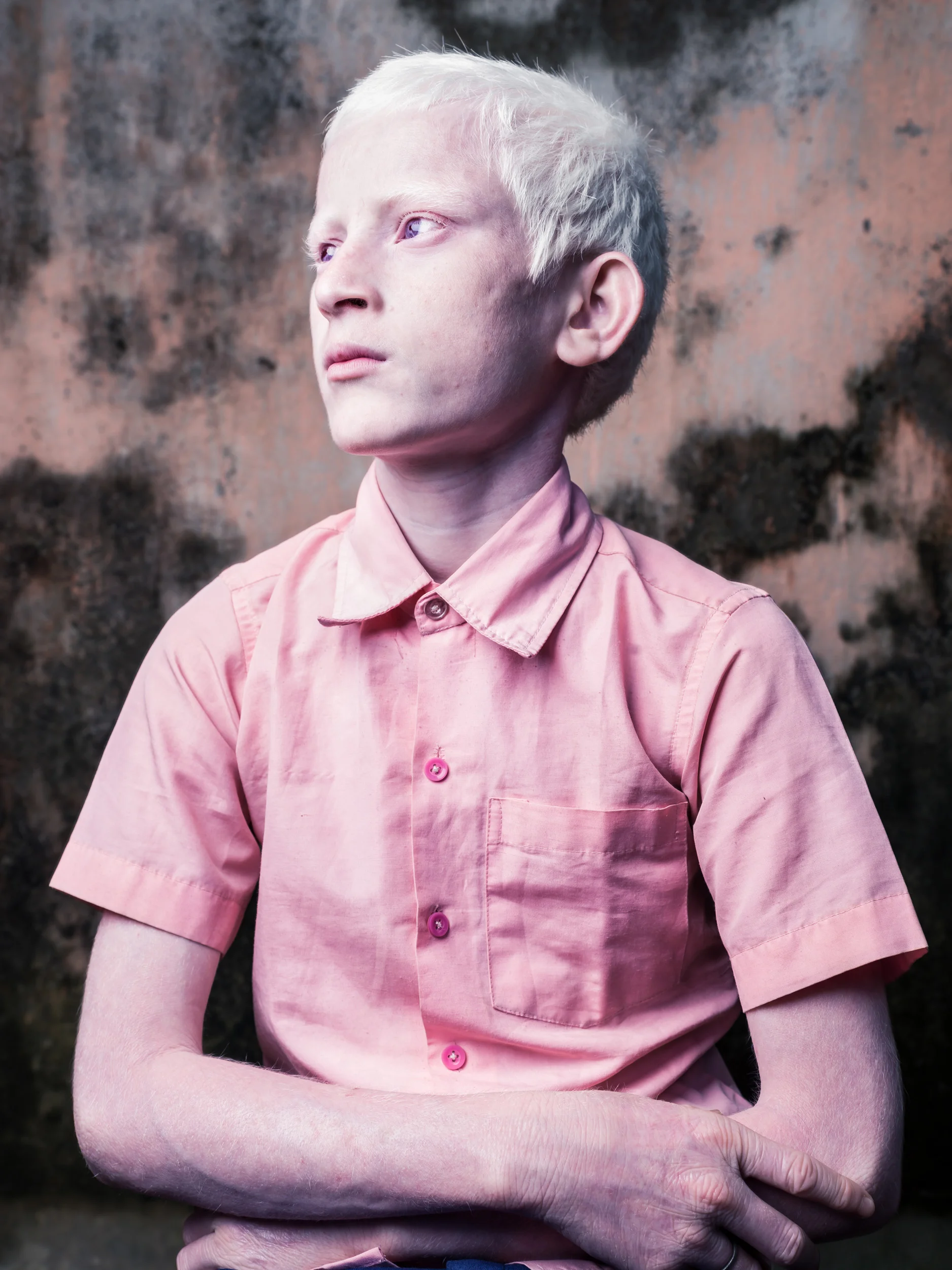 Blind Albino Boys - Vivekananda Mission School for the Blind - India, West Bengal, September 19, 2014.