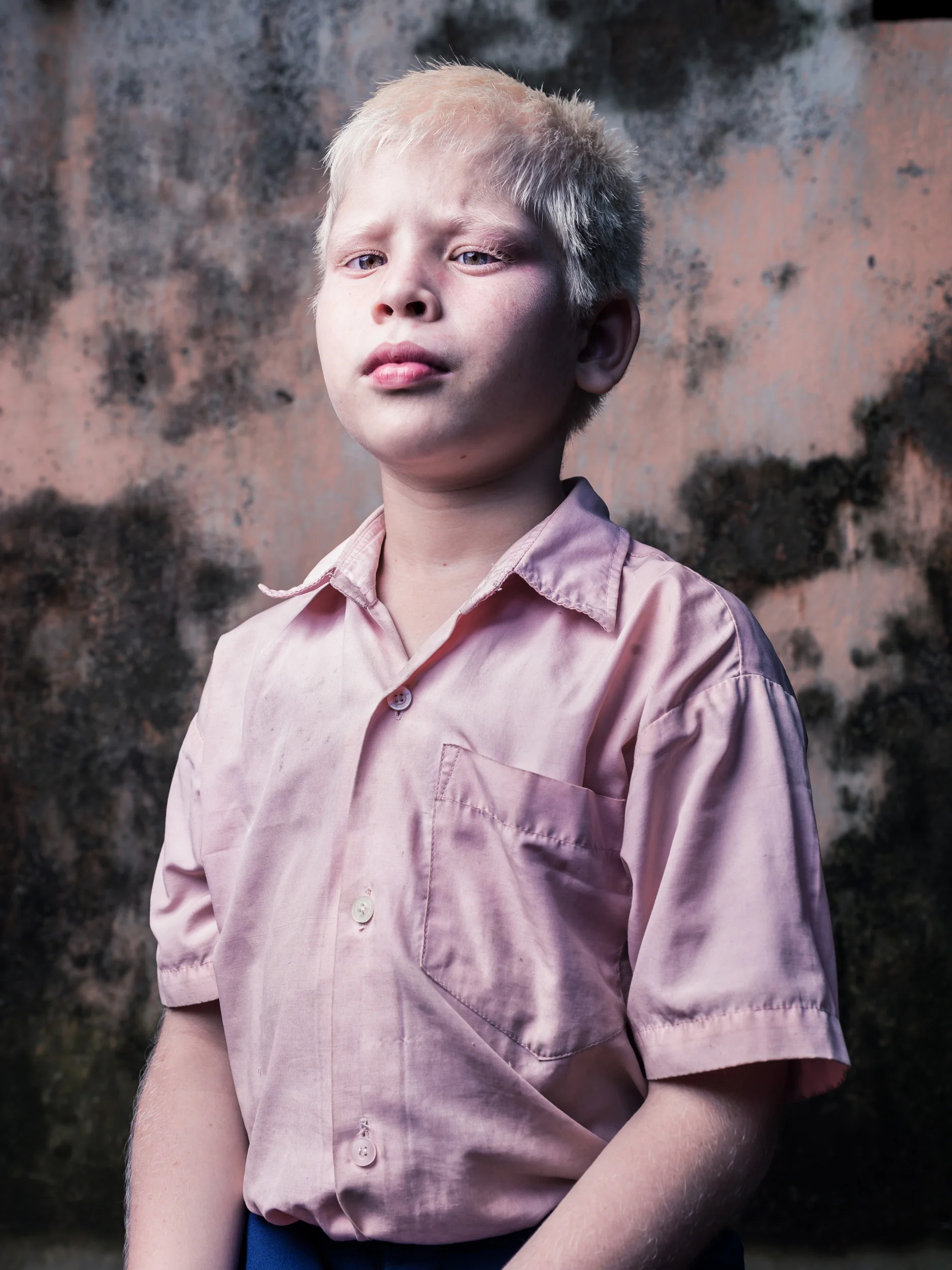Blind Albino Boys - Vivekananda Mission School for the Blind - India, West Bengal, September 19, 2014.