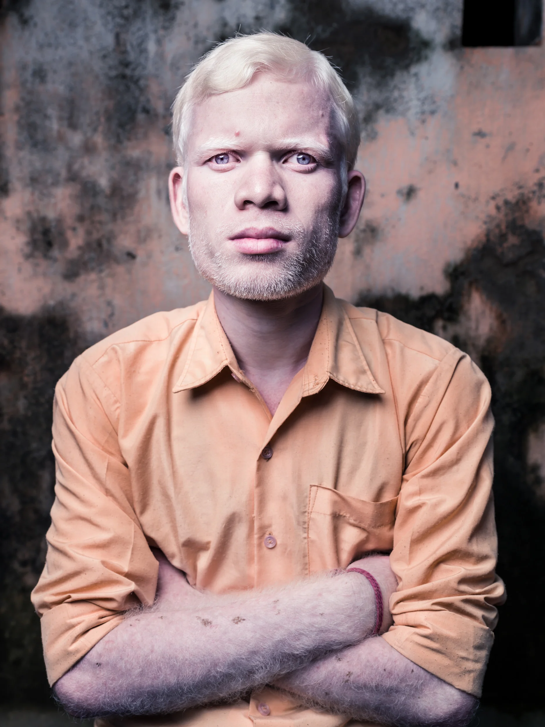 Blind Albino Boys - Vivekananda Mission School for the Blind - India, West Bengal, September 19, 2014.