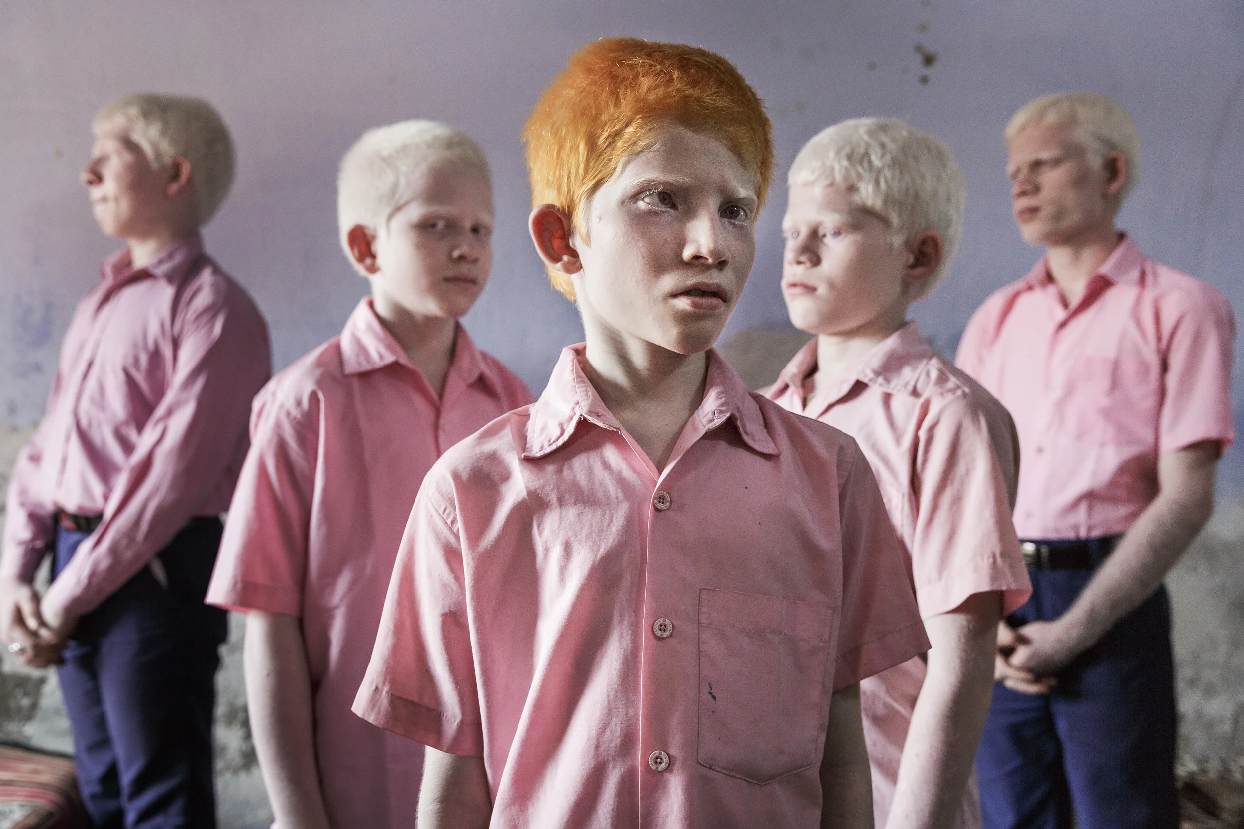 BlindAlbinism_03.jpg