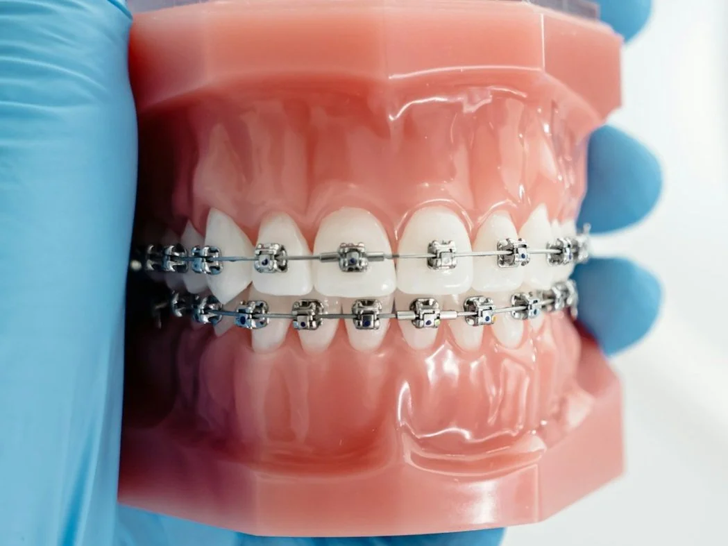 A woman with braces on her teeth touching her lower lip with her finger.