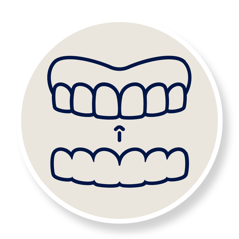 Close-up of a person inserting a clear aligners into their mouth.