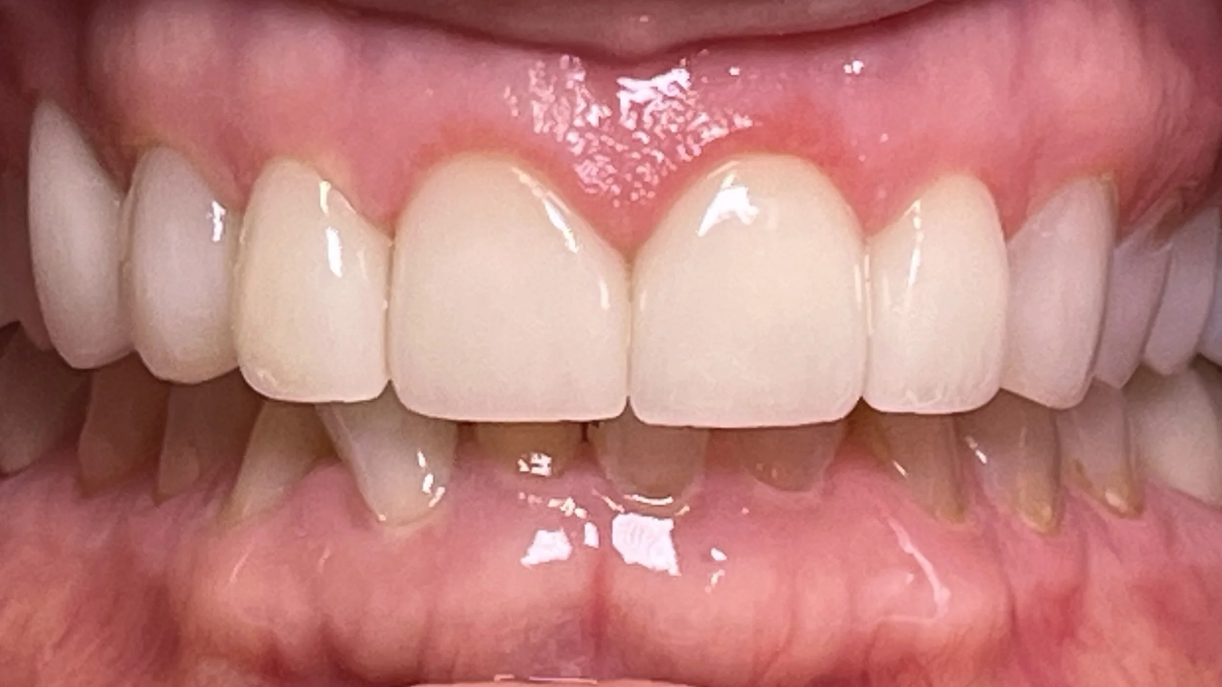 Vie-Lavelle-Smile-Design-After-Smile-IMG_3679.jpg