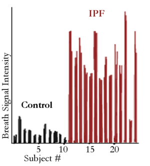 Secondary electrospray ionization proceeds via gas-phase chemical ionization.png