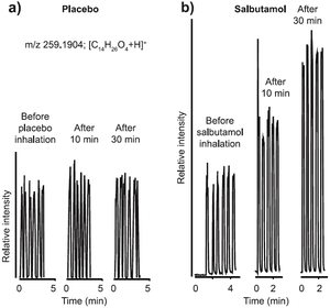 Metabolic effects of inhaled salbutamol determined by exhaled breath analysis