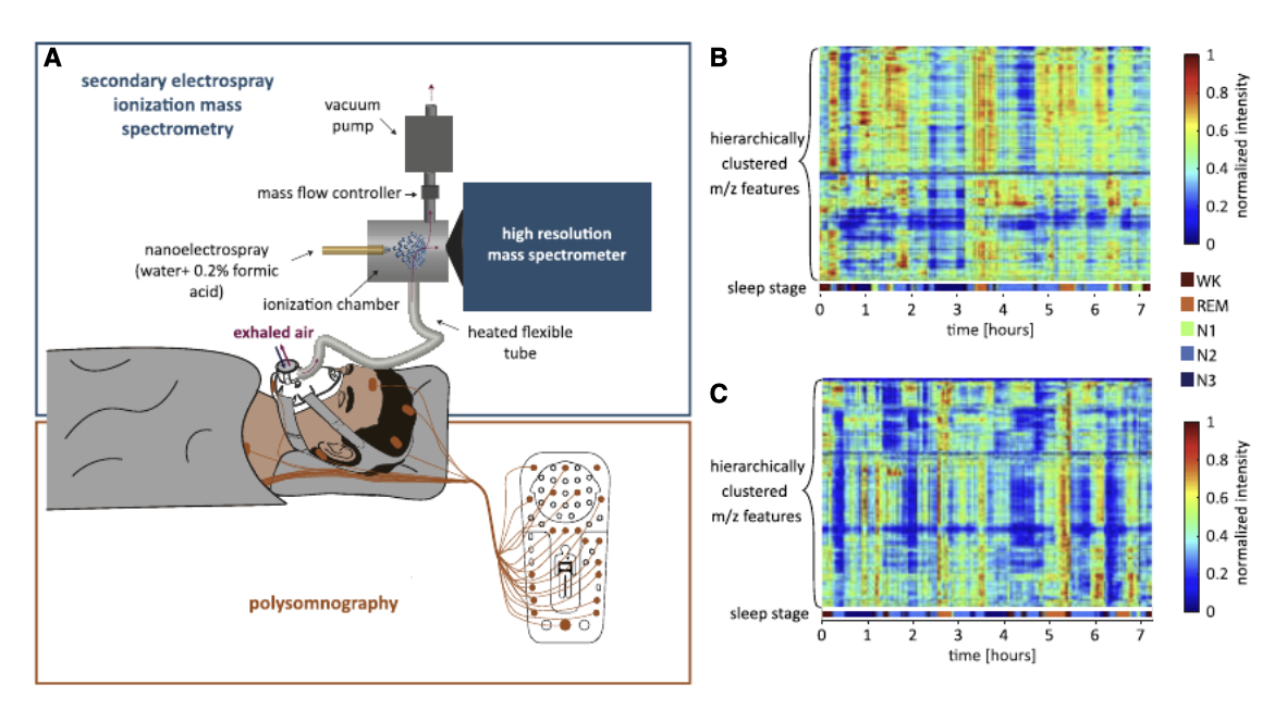 Rapid and reversible control of human metabolism by individual sleep states