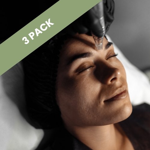 Microneedling treatment package in Colorado Springs for collagen stimulation and scar reduction. Prepay for three sessions and save $50 at Natural 10 Skin.