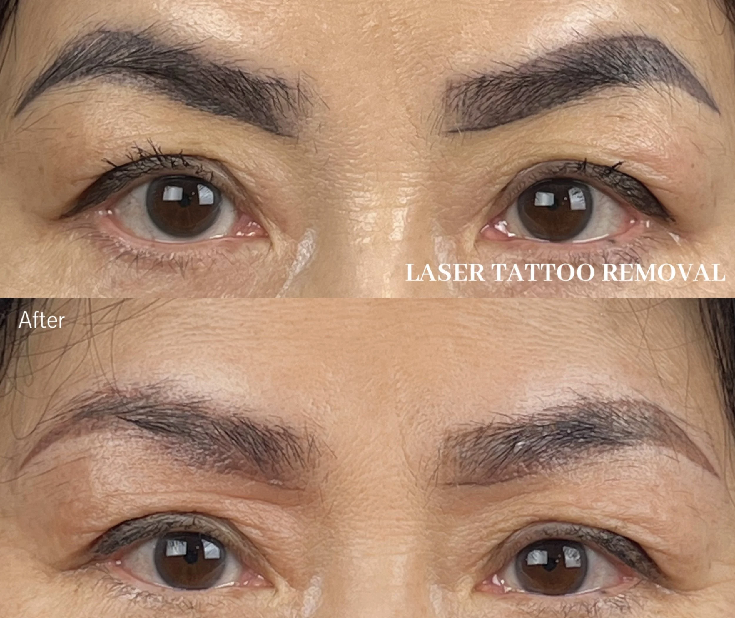 Why Old Pigment Doesn’t Fade &amp; How to Prevent It