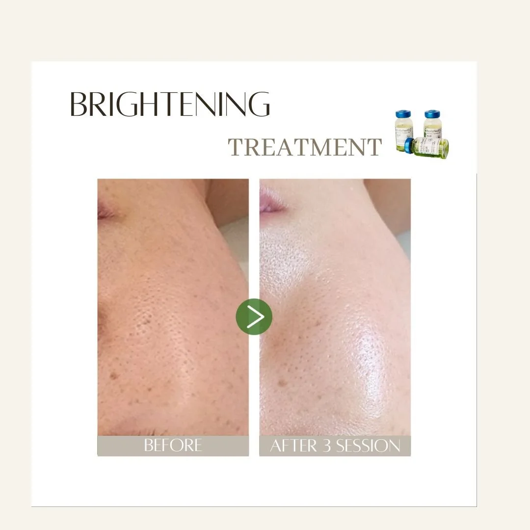 Comparison of skin before and after a brightening treatment, showing improved skin clarity and reduced pore appearance, with small bottles of skincare products in the top right corner.