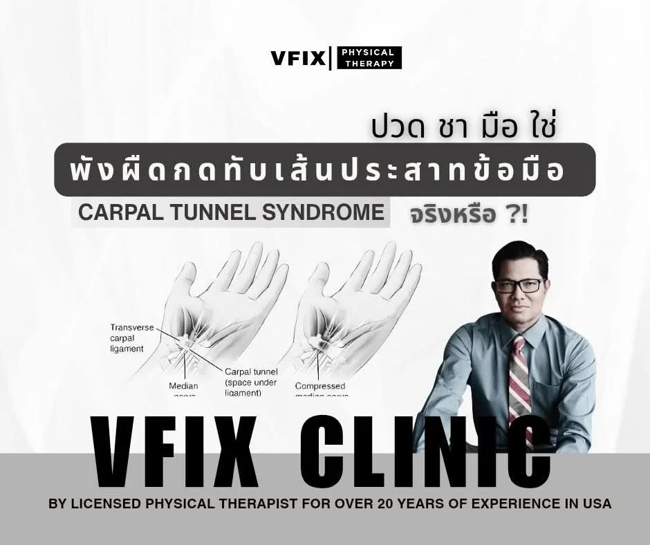 Carpal Tunnel Syndrome ชามือ เพราะเป็น พังผืดกดทับเส้นประสาทข้อมือ ทำไม ผ่าแล้วถึงมีอาการ 