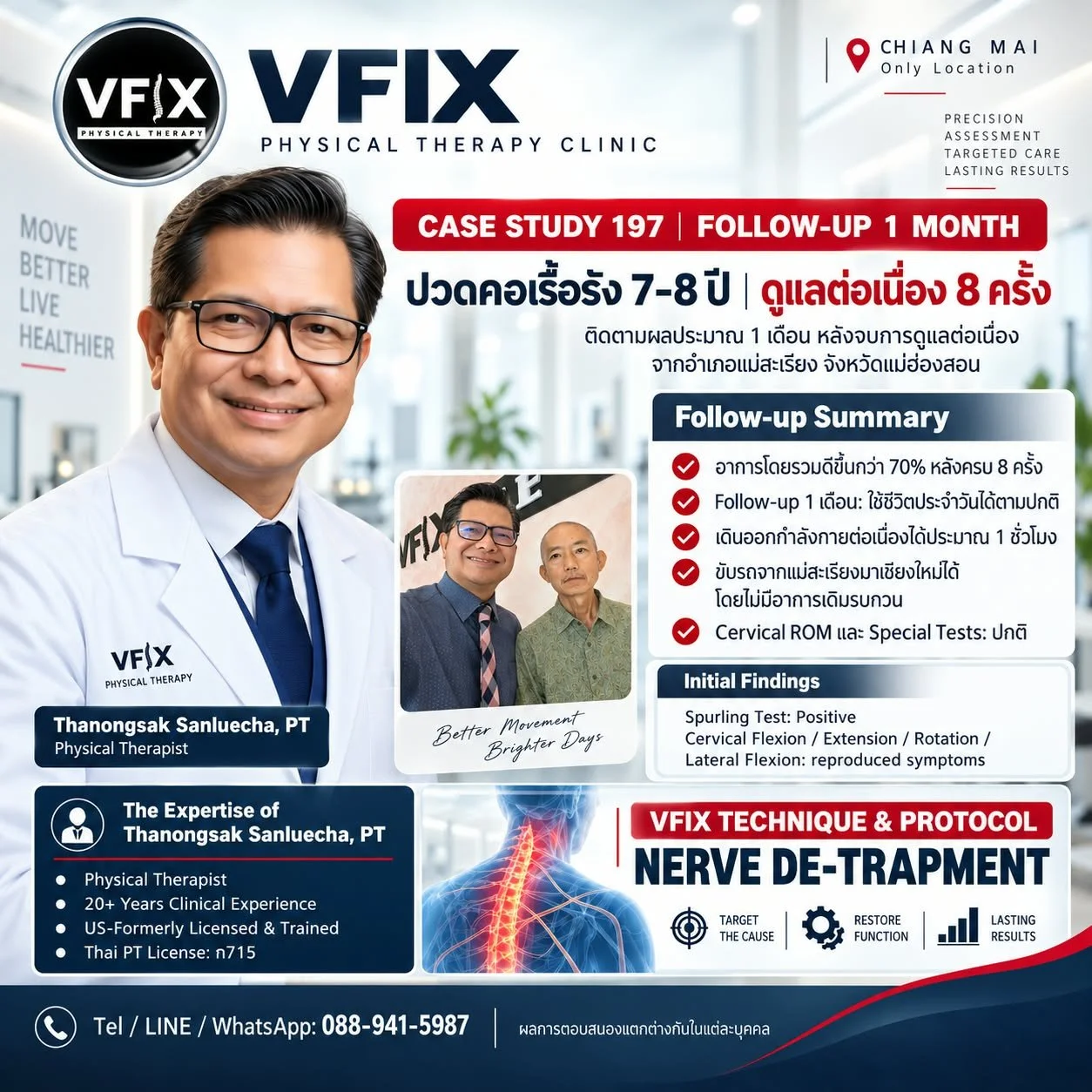 🗣️ **CASE STUDY 197 | FOLLOW-UP ประมาณ 1 เดือน ปวดคอเรื้อรัง 7–8 ปี | ติดตามผลหลังเข้ารับกายภาพบำบัดต่อเนื่อง 8 ครั้ง