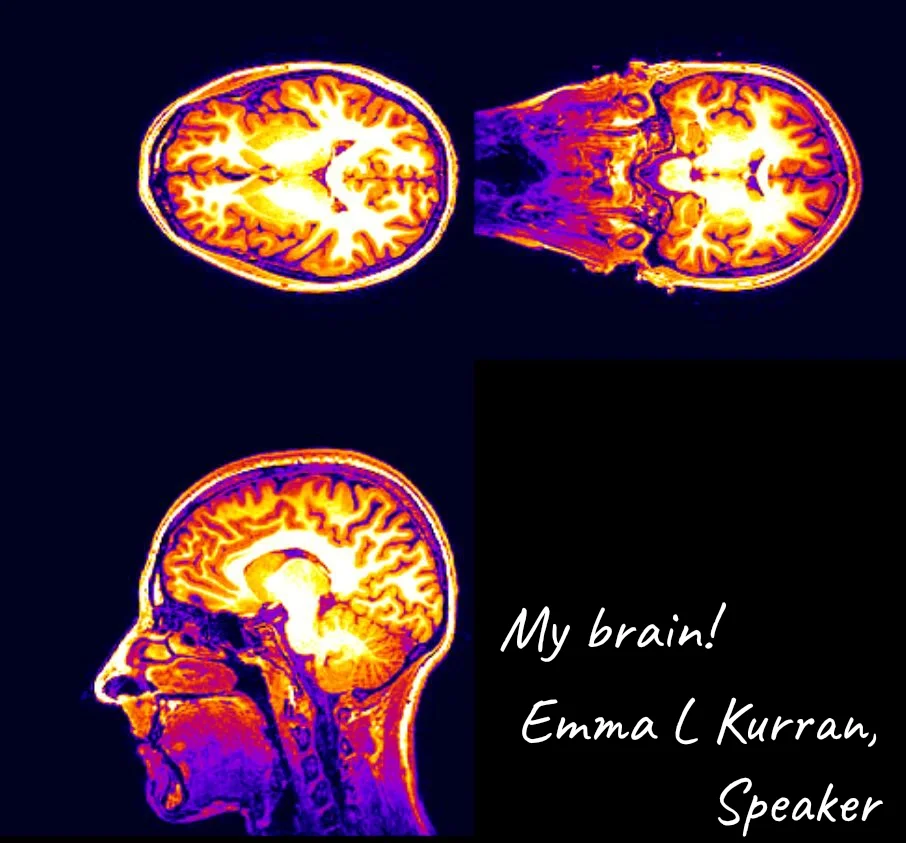 Three MRI scans of a human brain in various angles with a black background. Text overlay in white reads: "My brain! Emma L Kurran, Speaker."